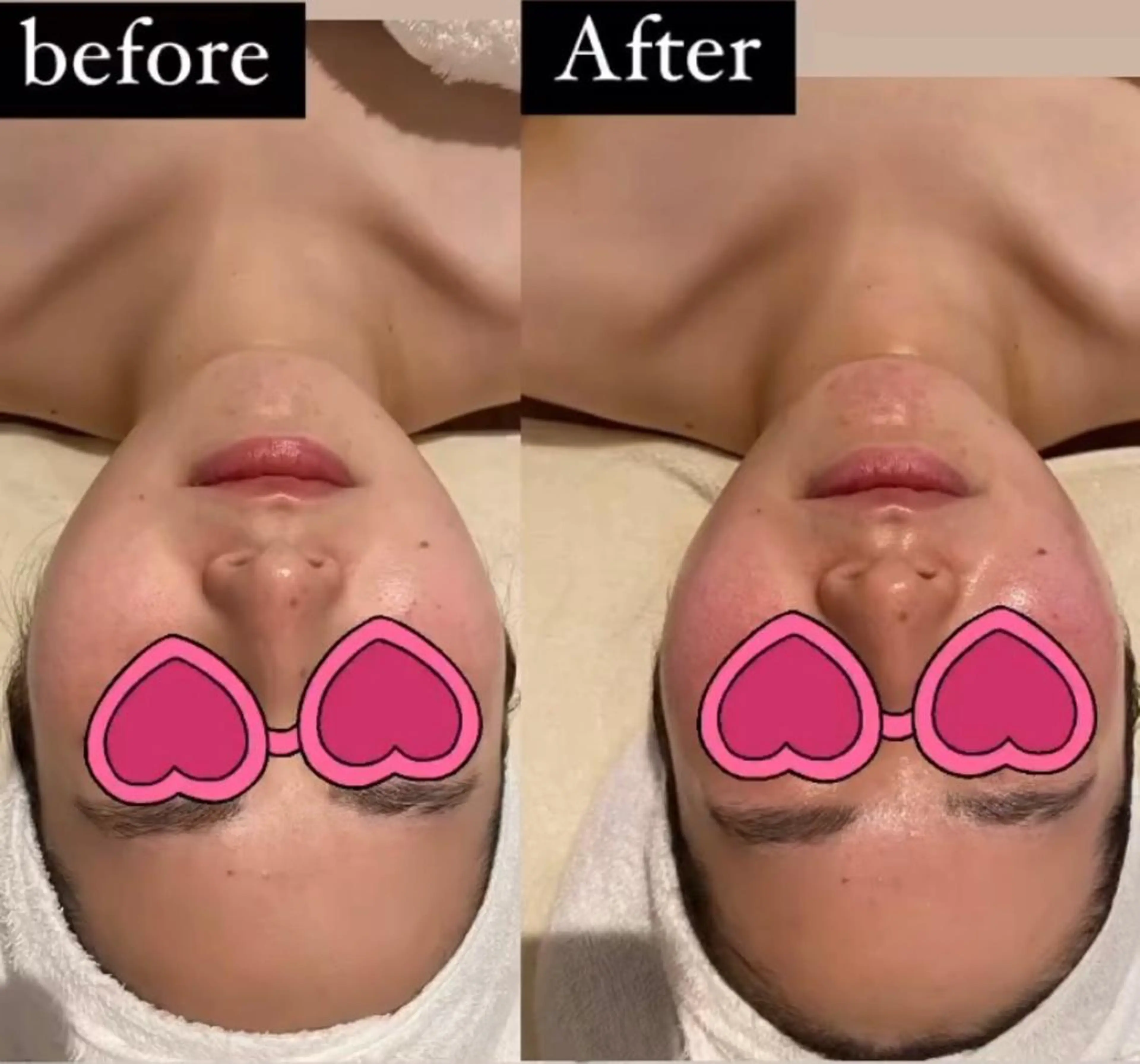 エステ リラク MENARD BLOOMのエステ・リラクイメージ