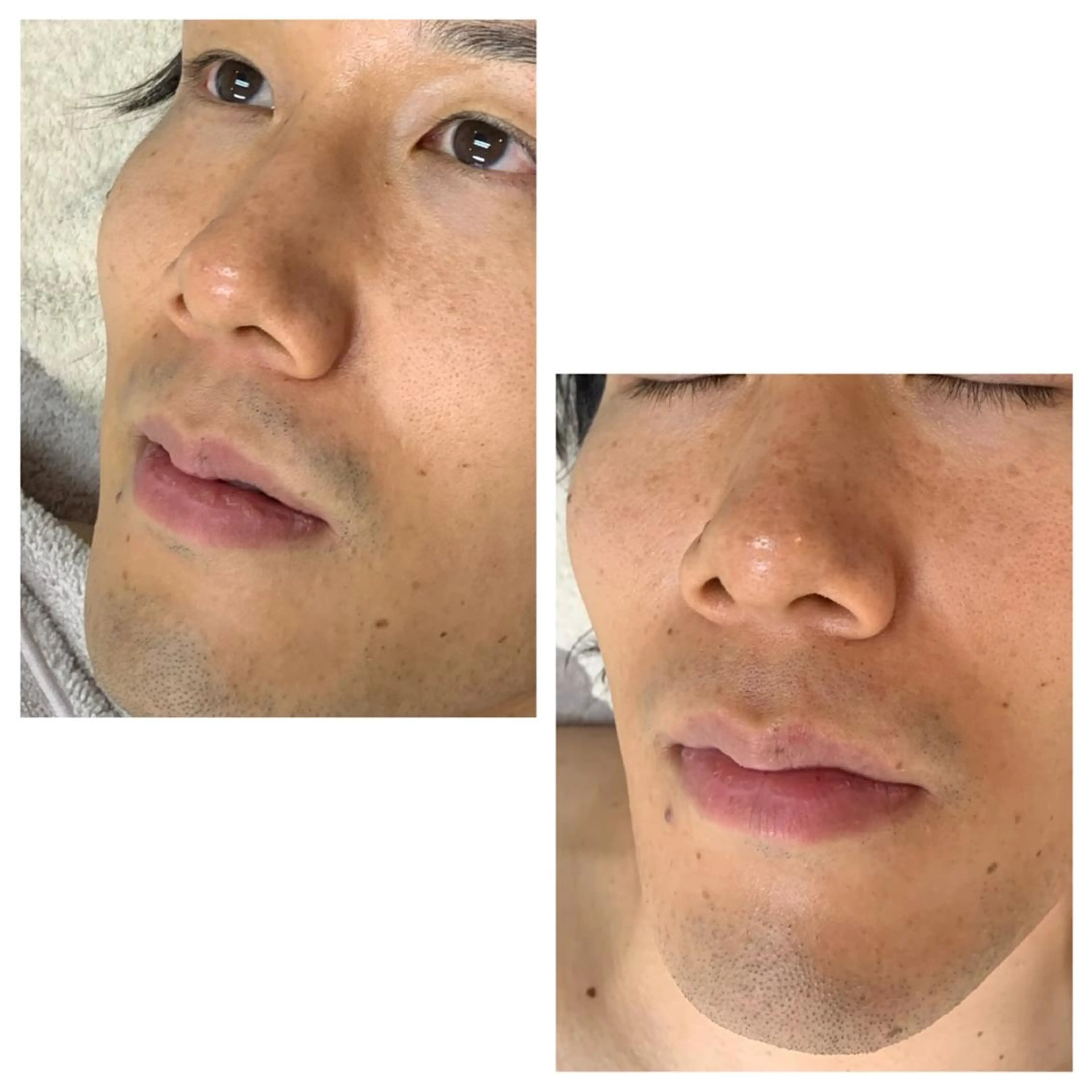 メンズ キッズ 脱毛 MISEREL岡崎店 Ayaのエステ・リラクイメージ