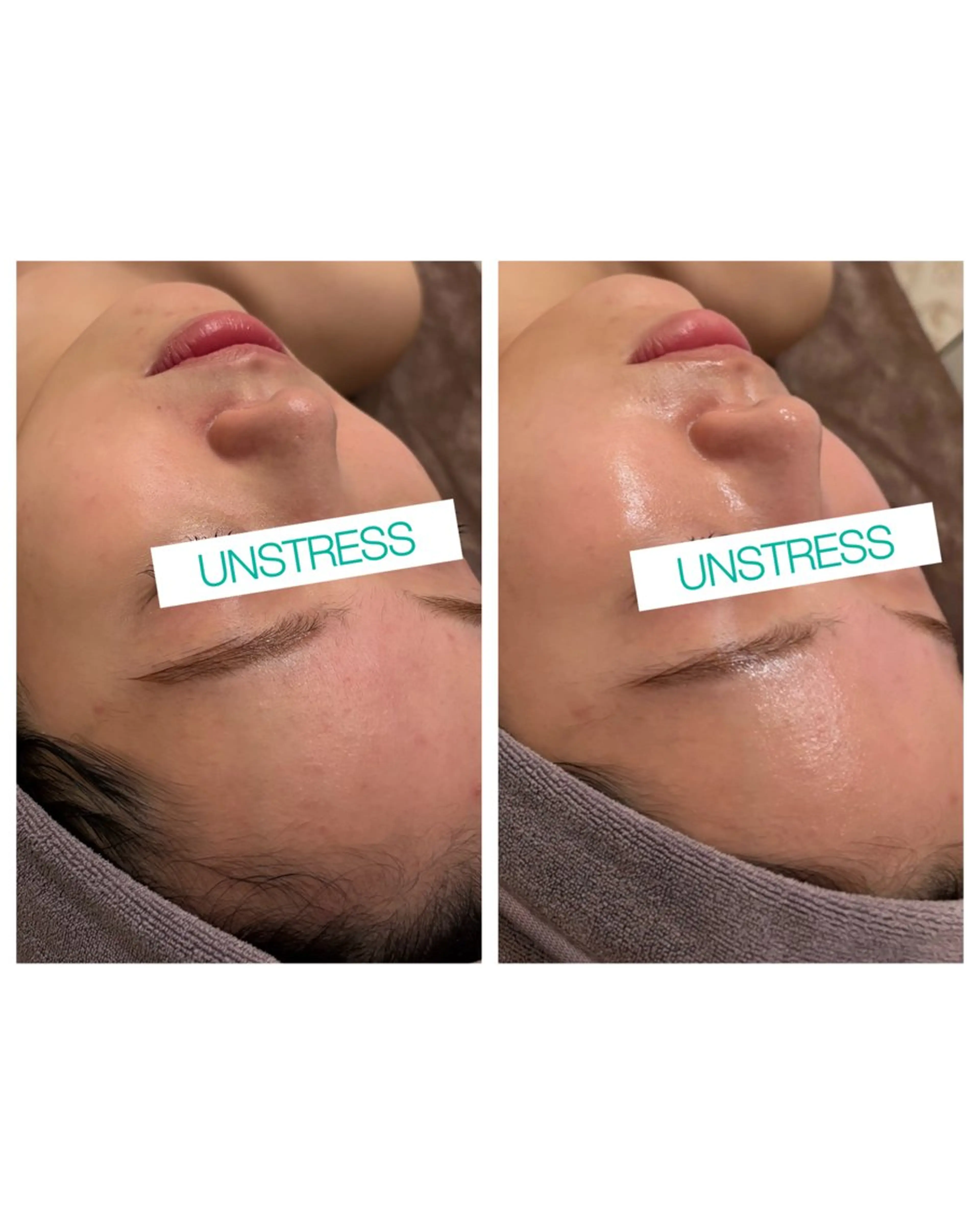 ☆痩身/小顔☆ 結果出します☆のエステ・リラクイメージ