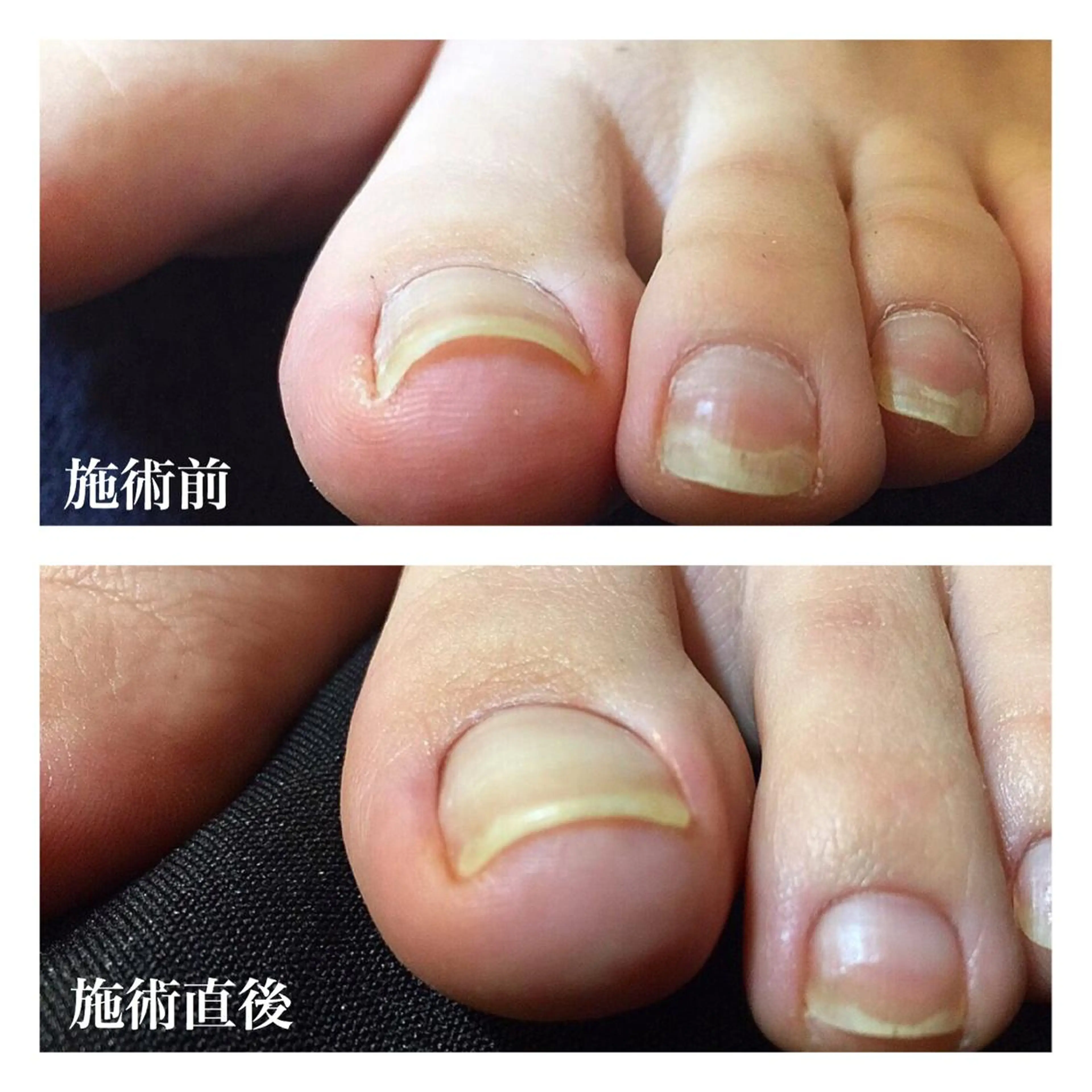 ネイル Viseo《6週間 長持ちパラジェル》のネイルデザイン