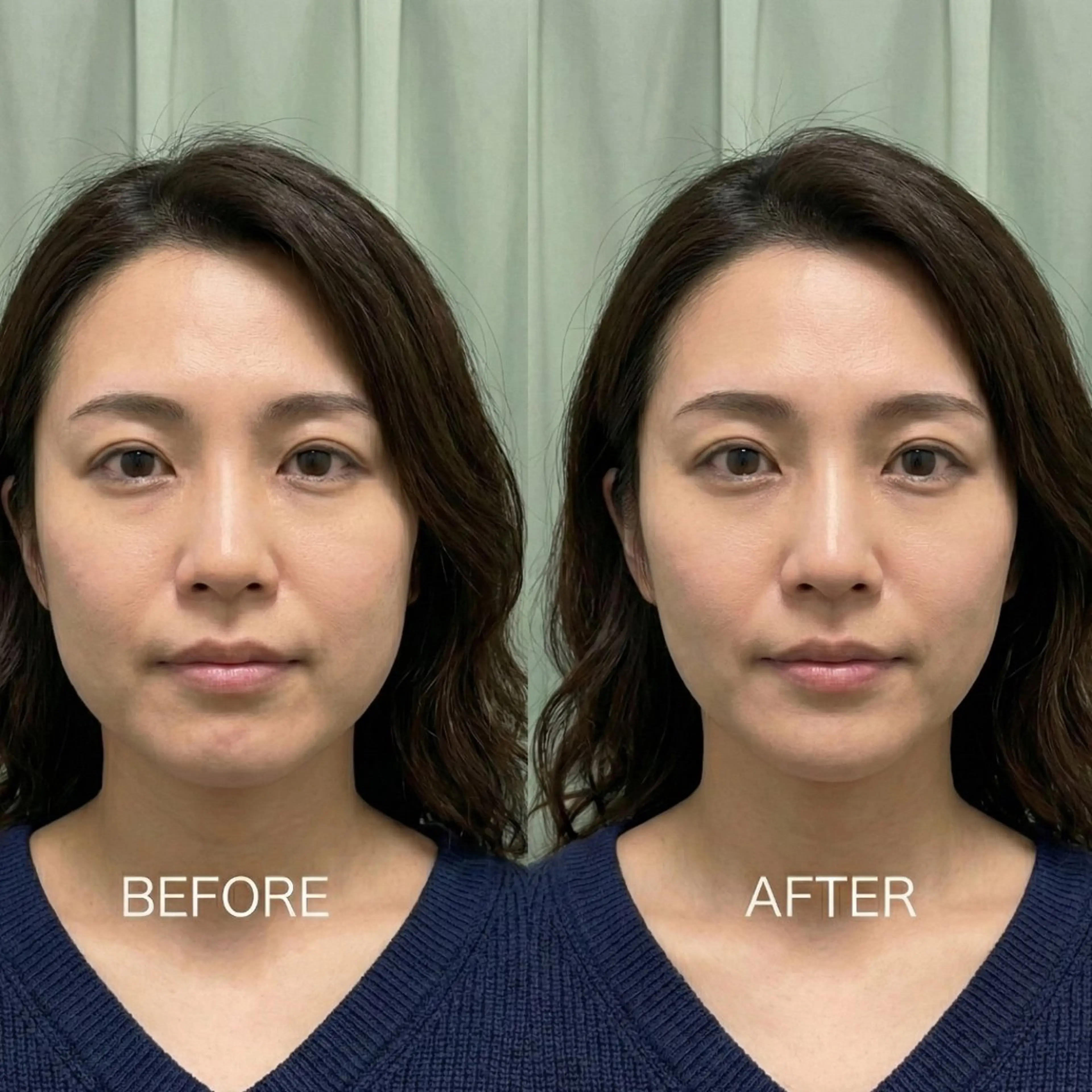 美容鍼DAZZLE マスザキのエステ・リラクイメージ