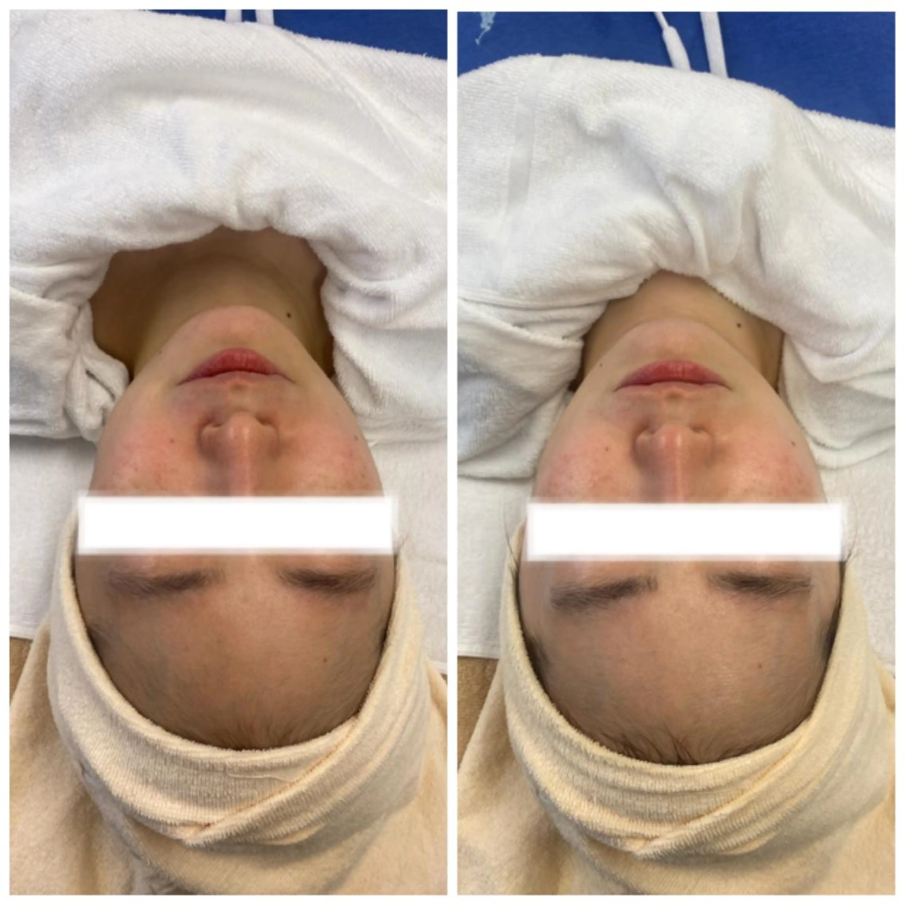 ネイル マツエク・マツパ アイブロウ 赤色 エステ リラク 肌質改善美容サロン ému 用賀のエステ・リラクイメージ