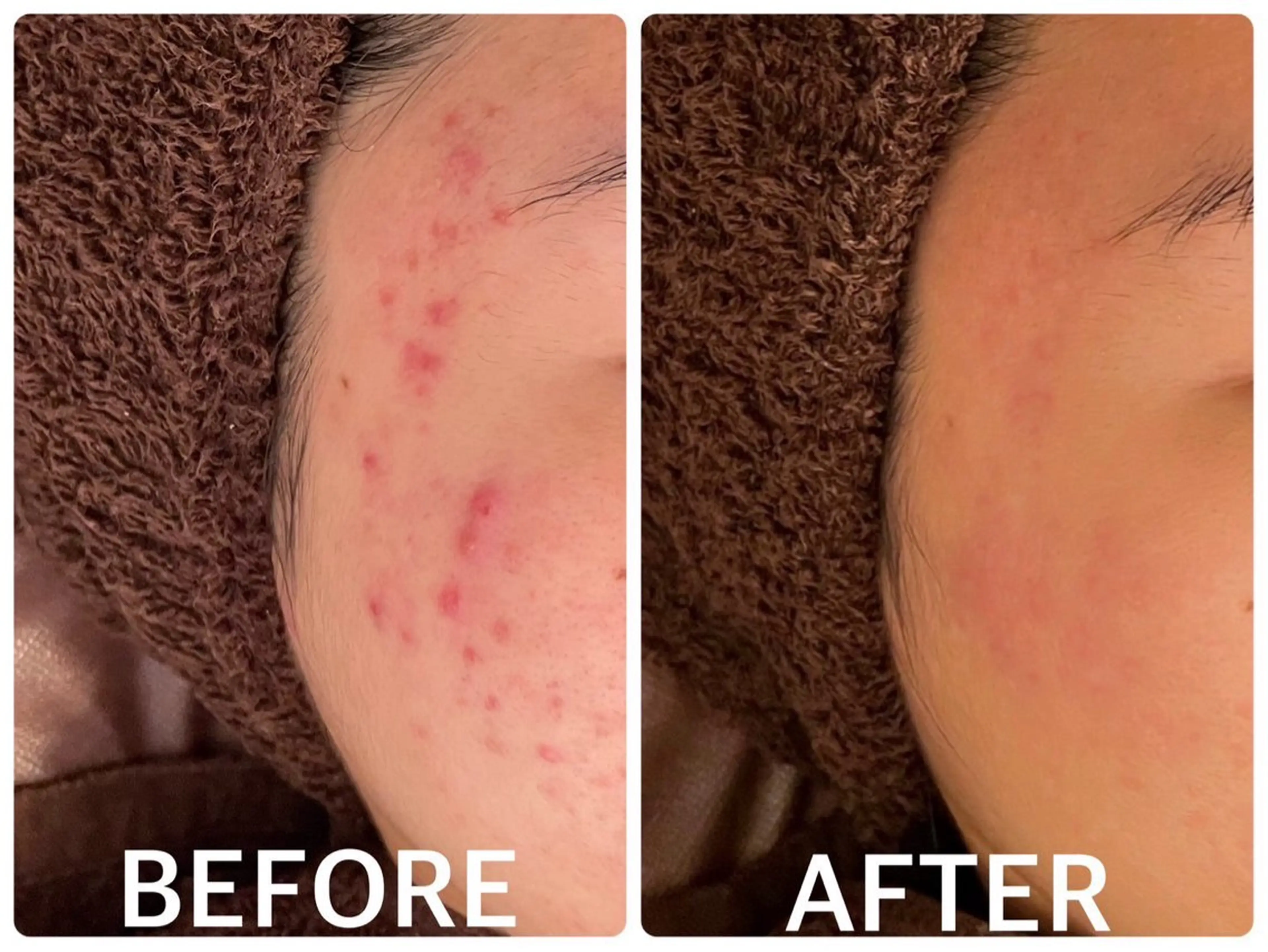 ハーブピーリング 横浜のエステ・リラクイメージ