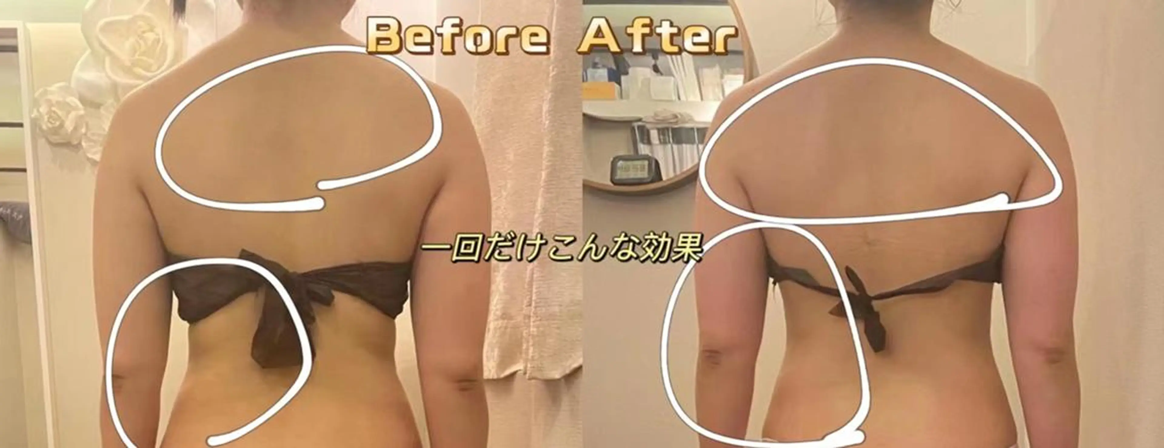 ★痩身＆リラク★【60分やり放題】☆ハイパーナイフ&リンパマッサージ¥7800の写真