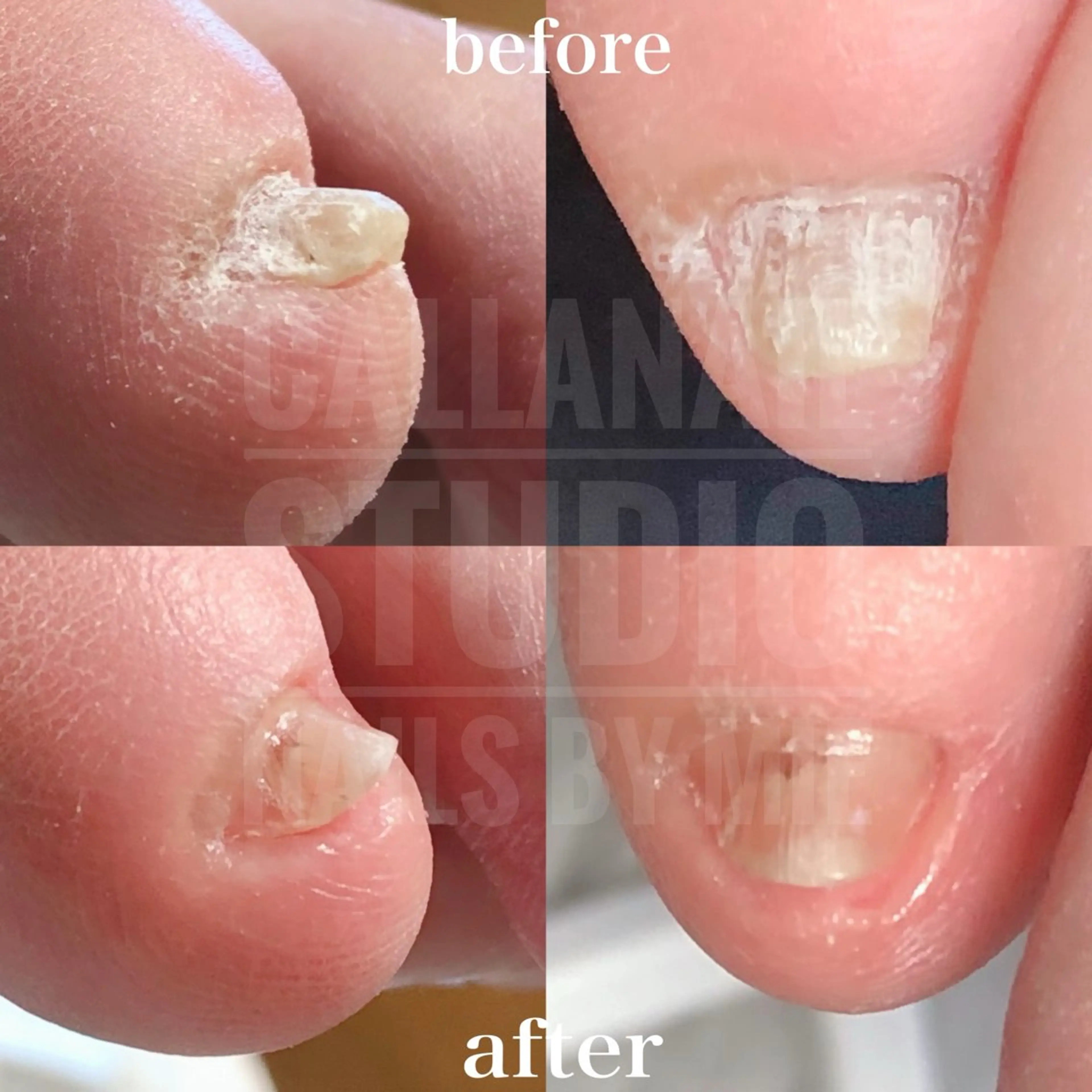 ネイル その他(ネイル) mie ミイのネイルデザイン