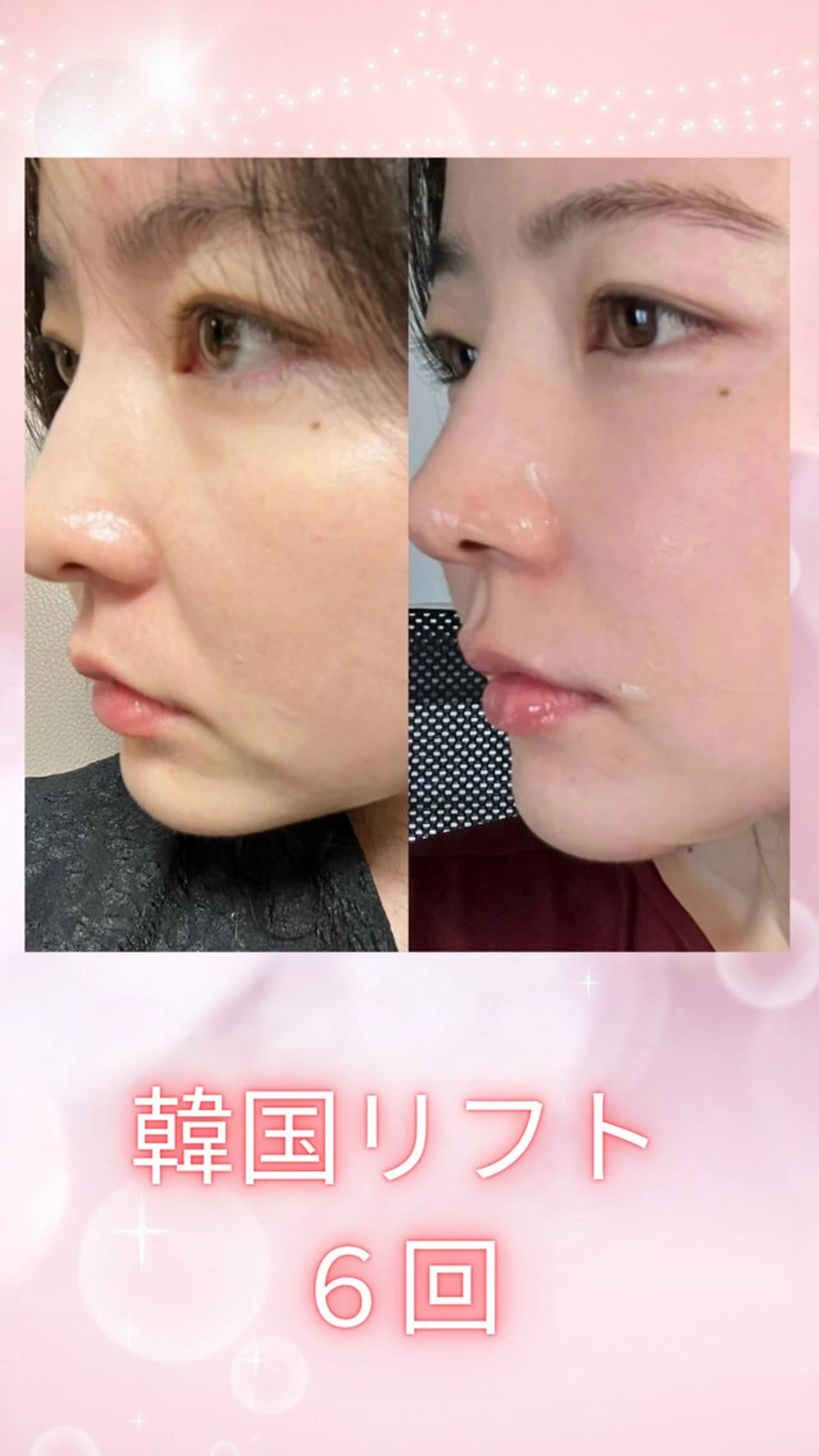 マツエク・マツパ エステ リラク 愛維美水光美肌専門店所属・愛維美水光美肌専門店 メンズレディースokのエステ・リラクイメージ