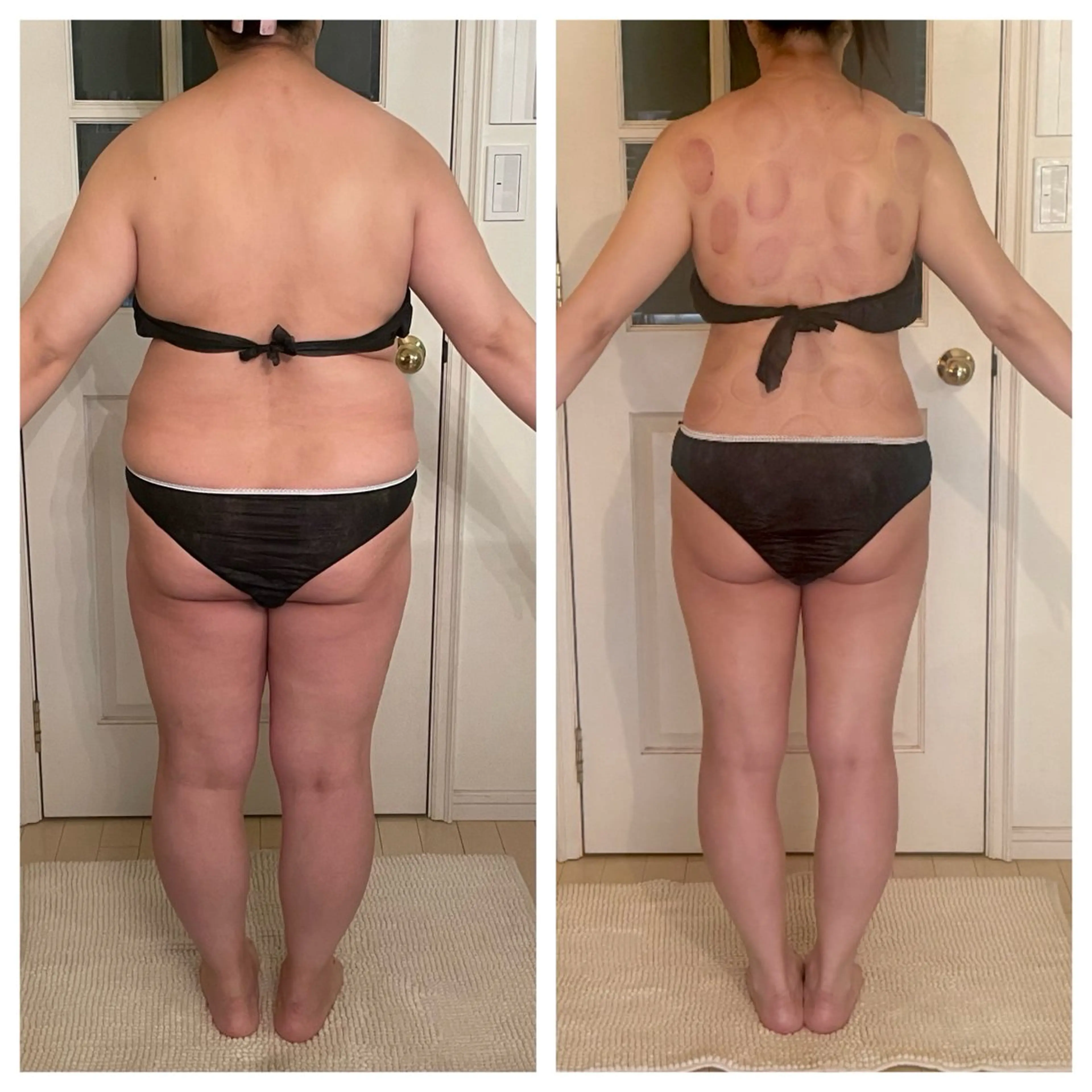 エステ リラク 吸い玉痩身専家所属・吸い玉 痩身専家FDLのエステ・リラクイメージ