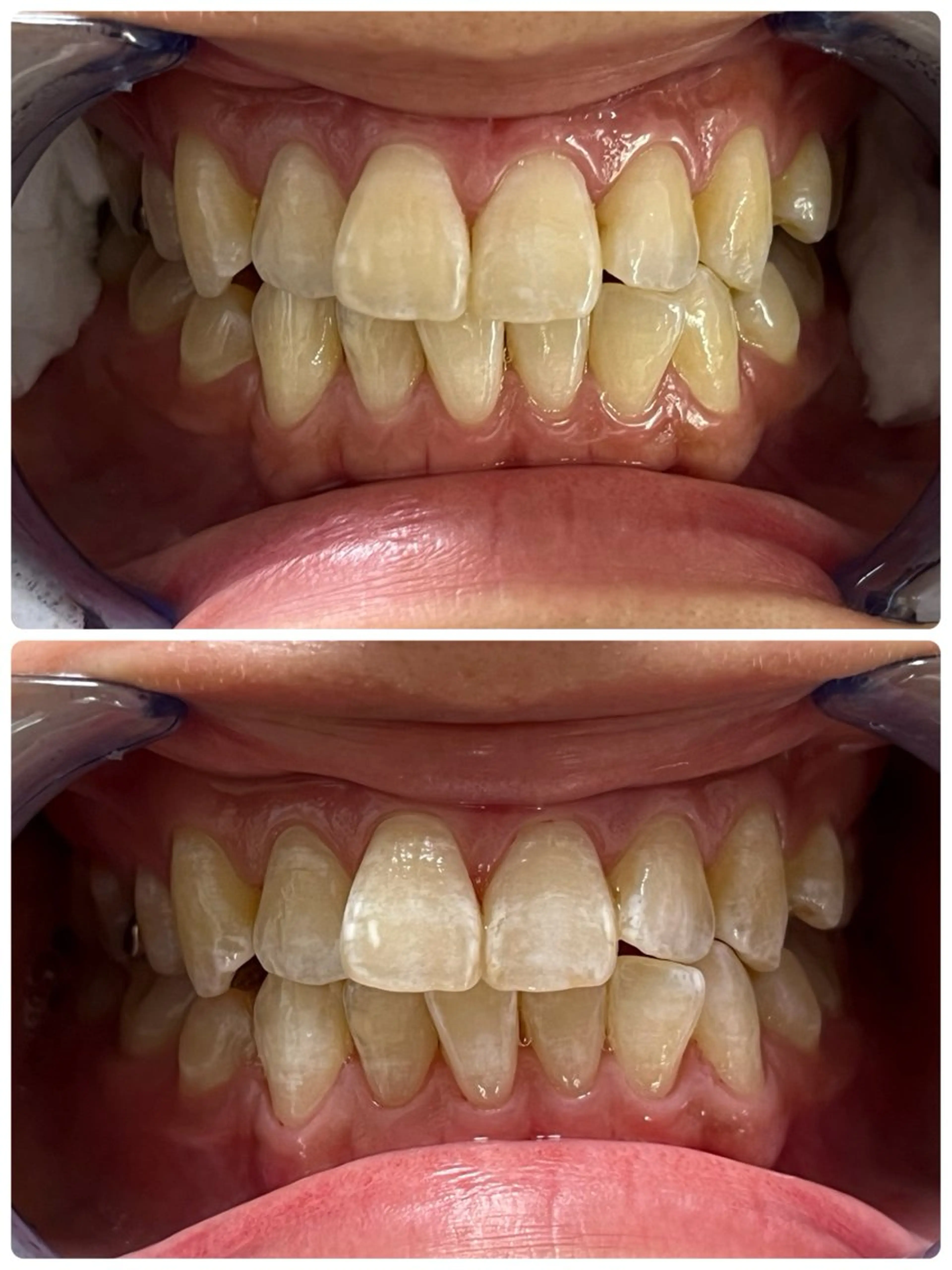 その他 エクシア ホワイト 宇治小倉店のその他イメージ