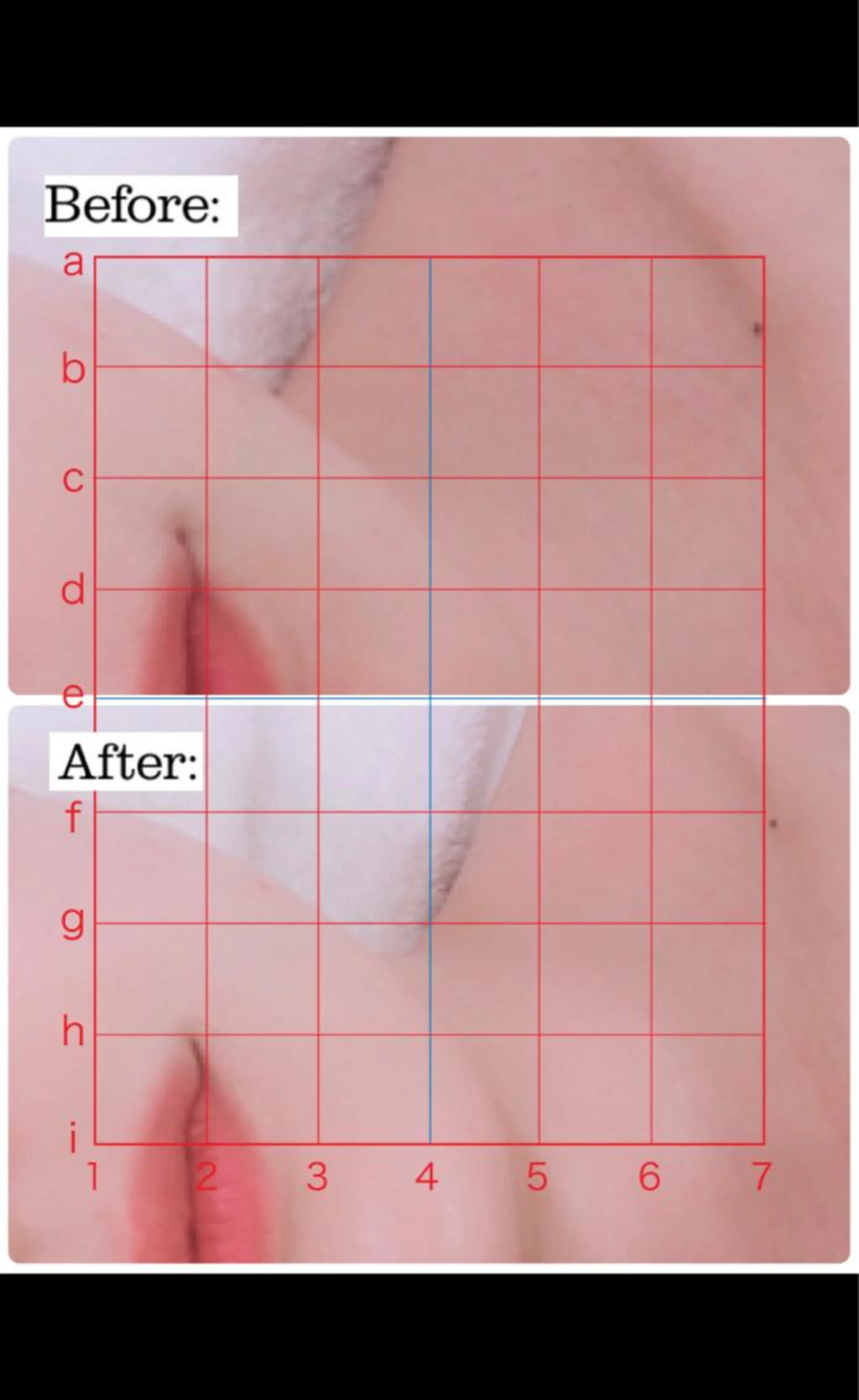 初回❣️小顔輪郭調整❣️(フェイシャルトリートメント付き)の写真