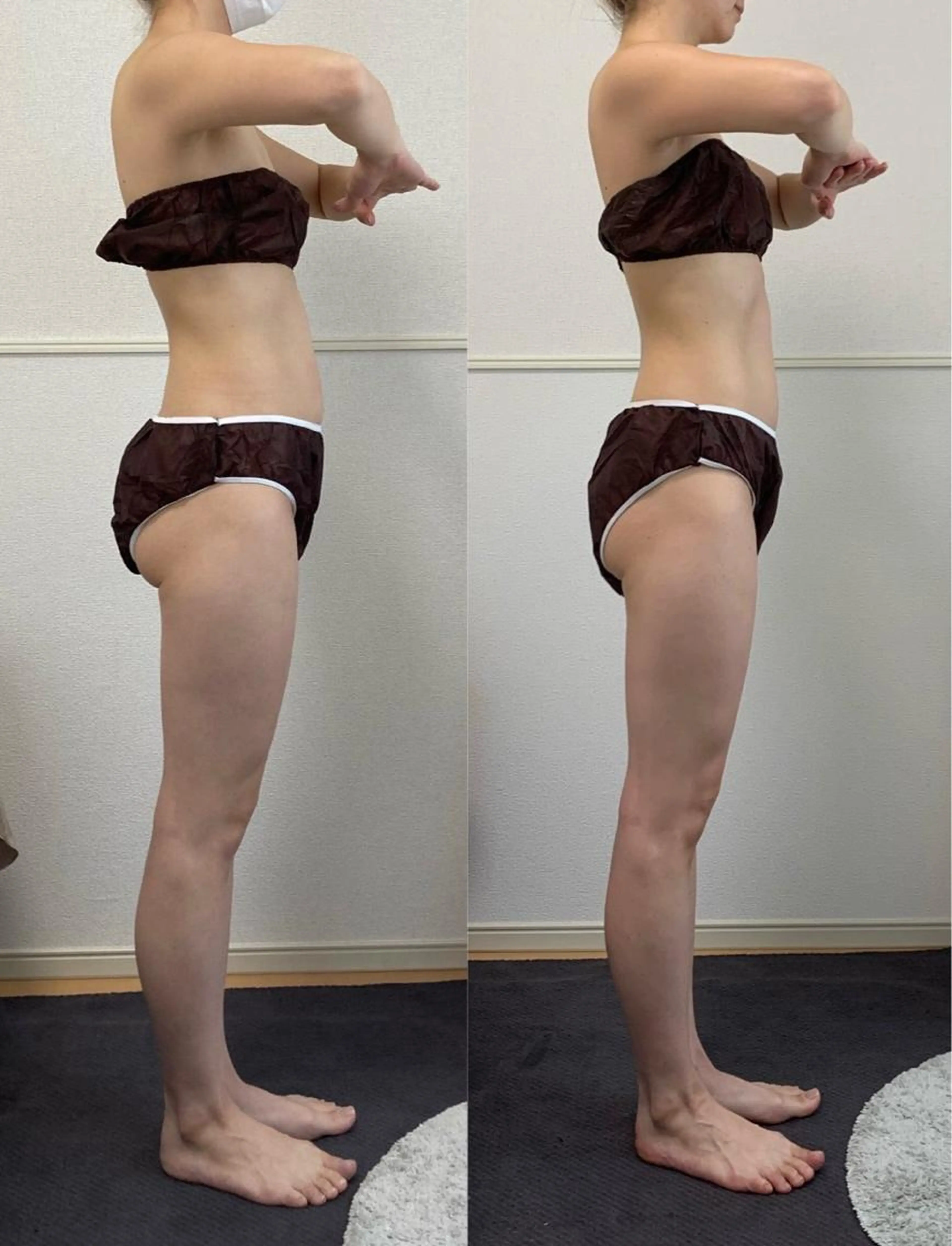 大人気！！痩身メニュー！　　　　　　　　　　　　　　　オールハンド筋膜リリース120   初回の写真