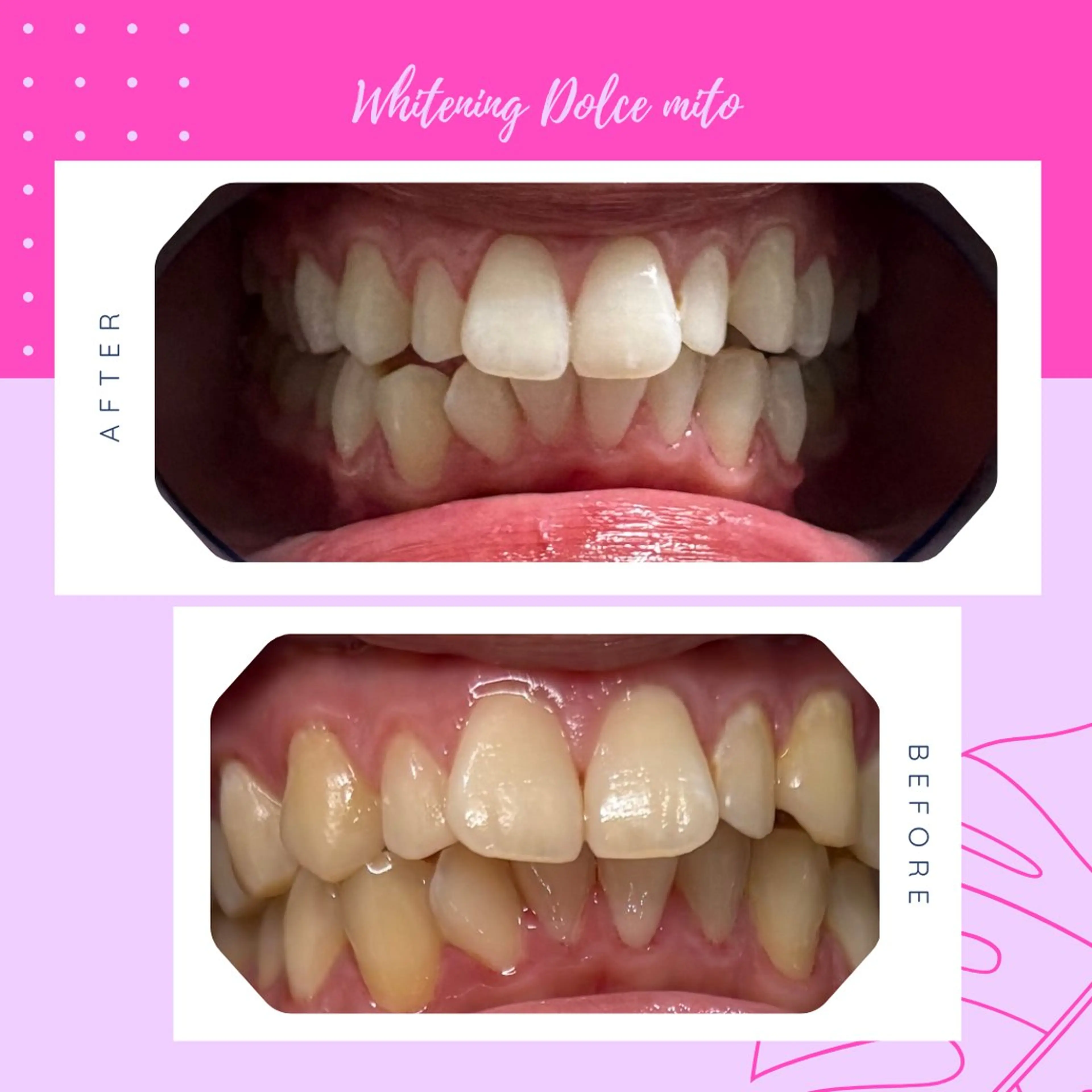 セルフホワイトニング Dolce水戸店のその他イメージ