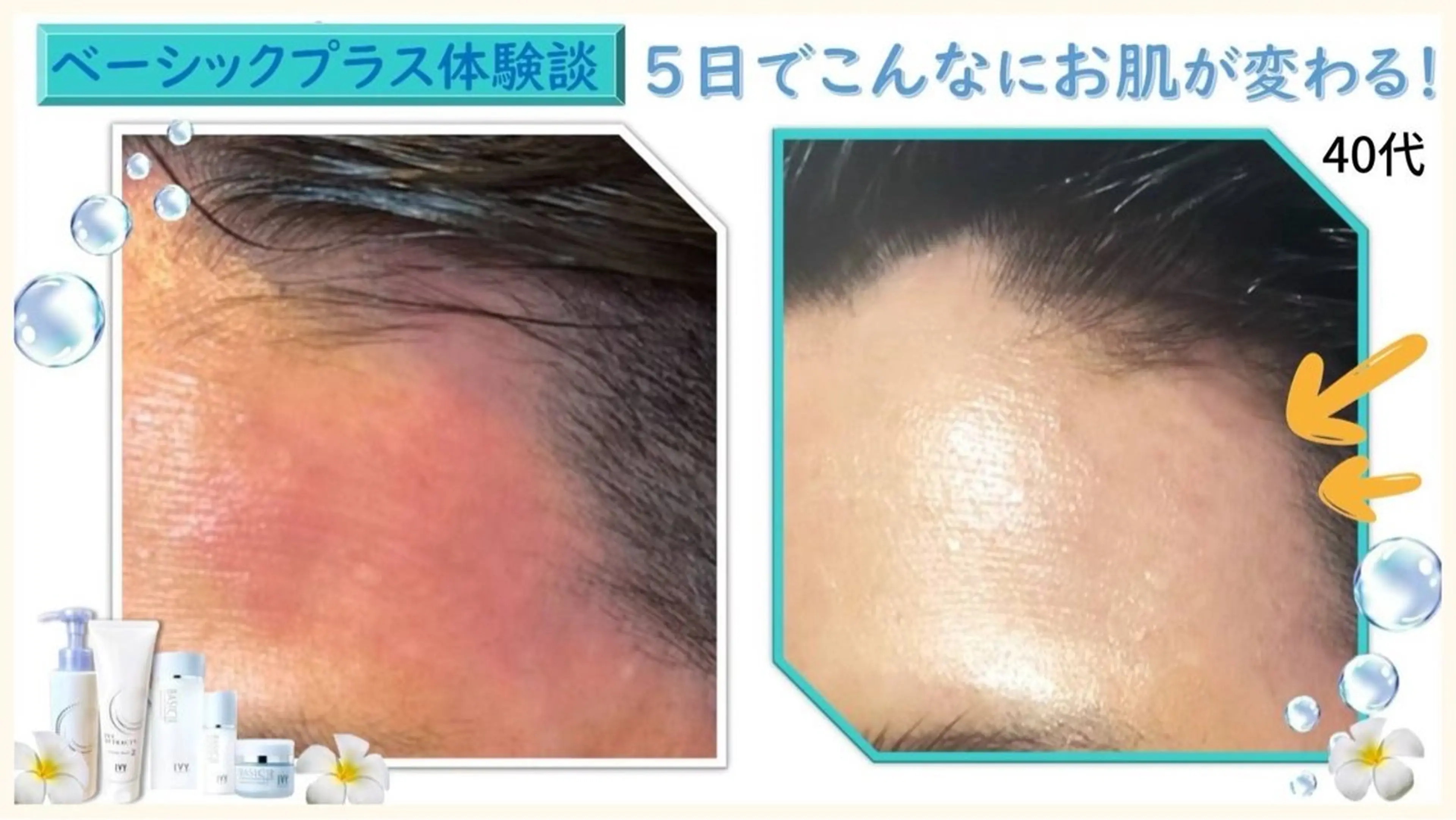 シミシワタルミ改善 美肌サロン松本浩美のエステ・リラクイメージ