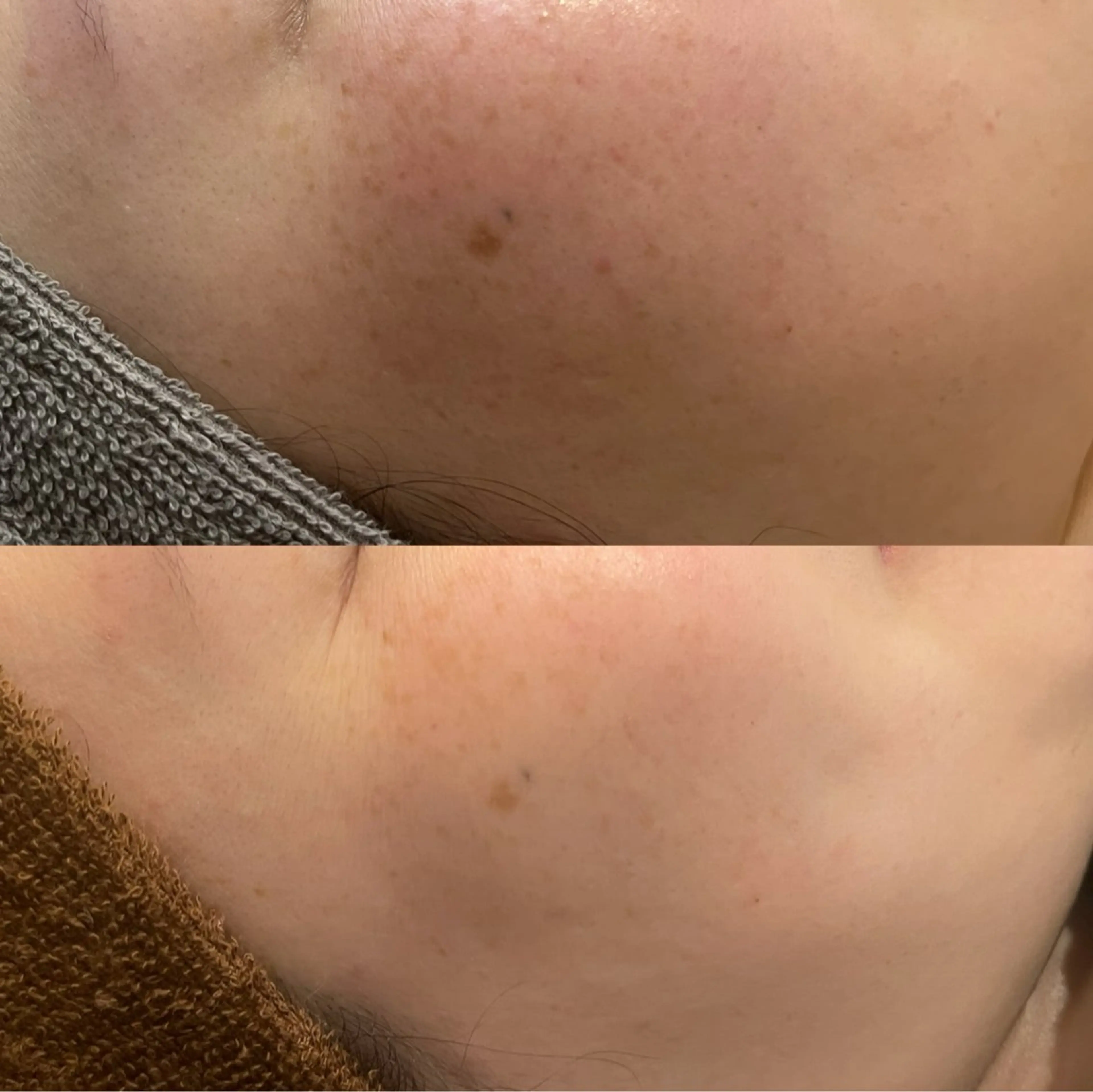 シミケア専門店モルセラ所属・シミケア専門店 モルセラのエステ・リラクイメージ