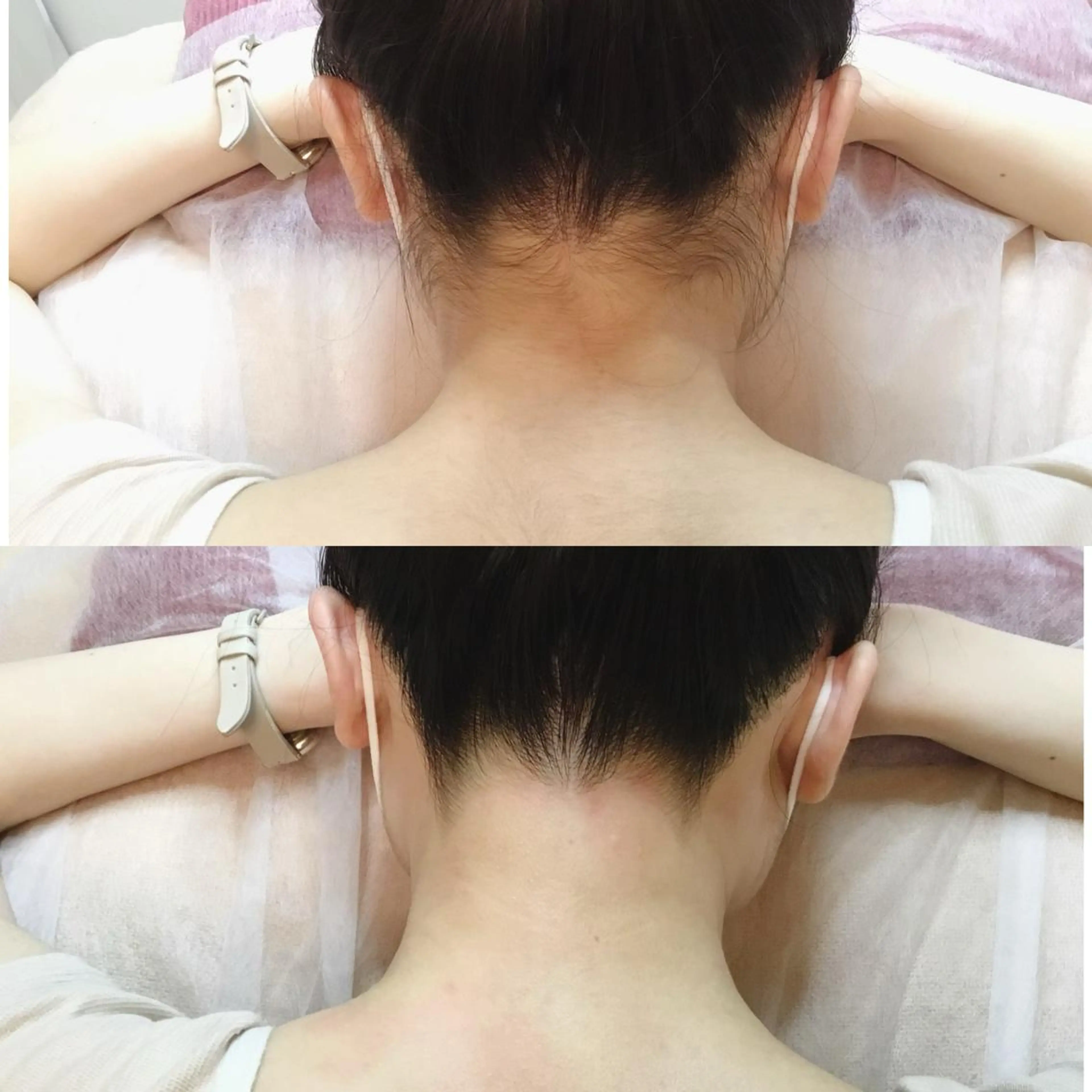 脱毛 SHIKI モリンガ蒸し/水光肌のエステ・リラクイメージ