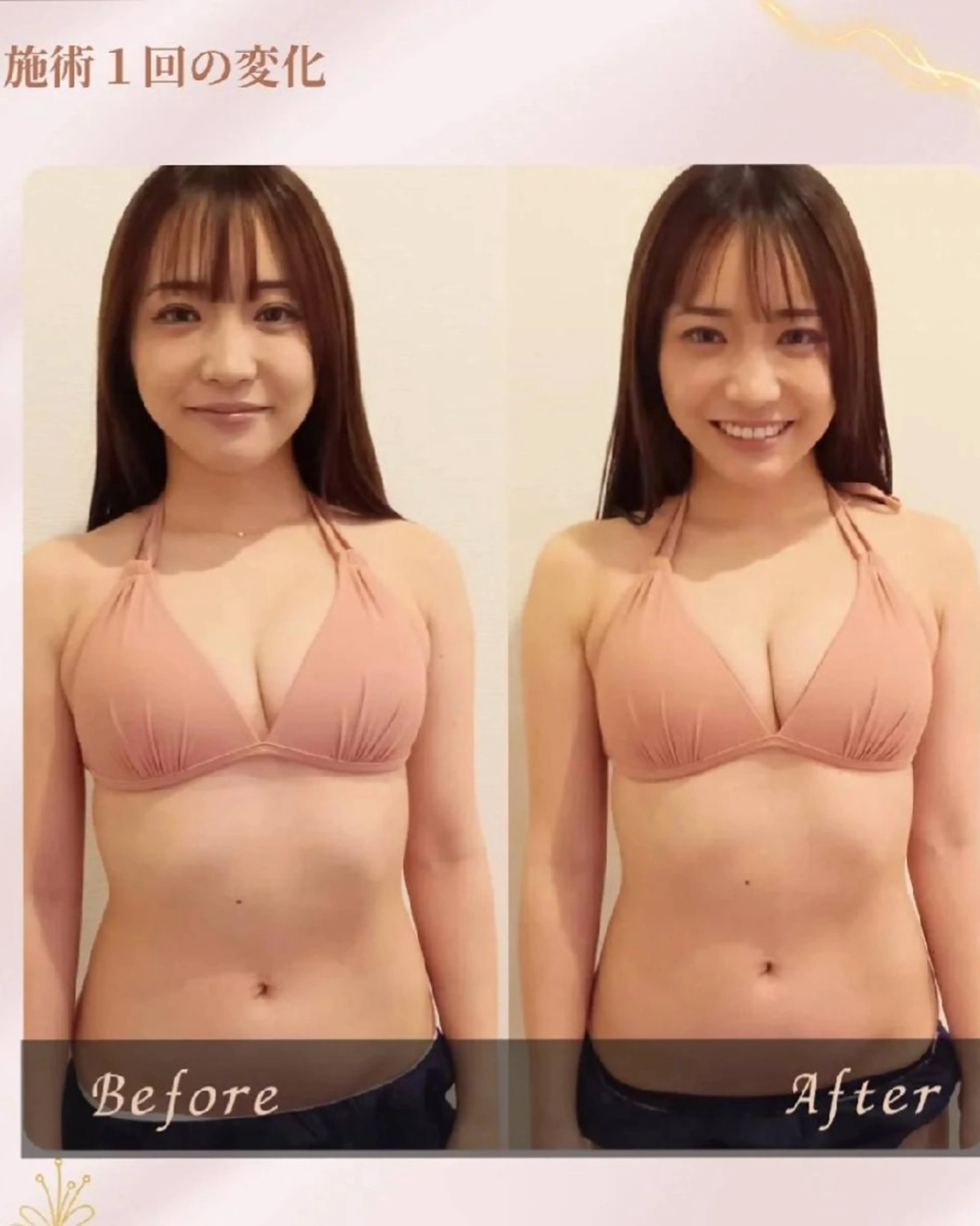 エステ マシュマロバスト coucouのエステ・リラクイメージ