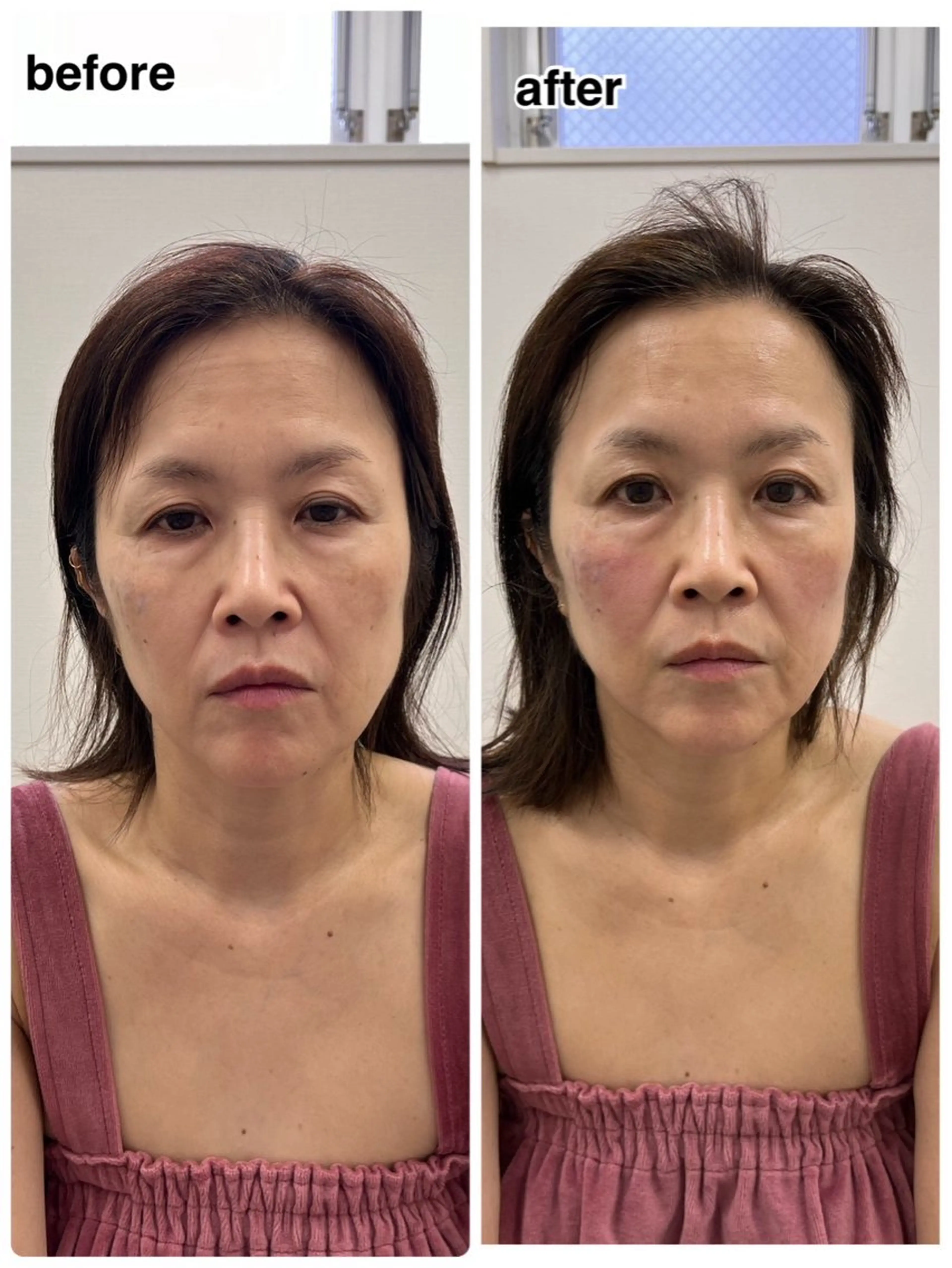 エステ MIRAI小顔 名古屋店のエステ・リラクイメージ