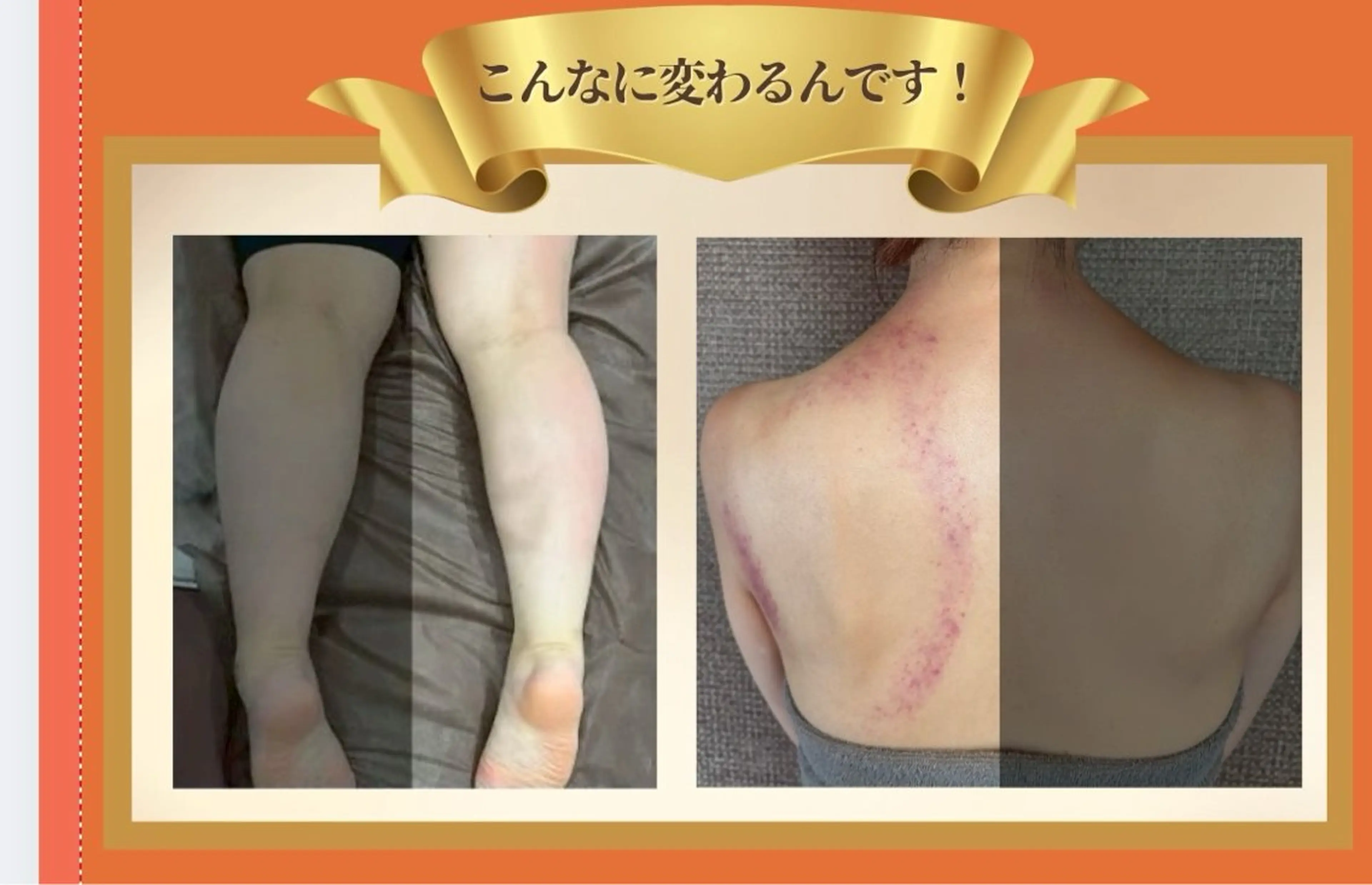 メンズ 屋根裏サロン 小室のエステ・リラクイメージ