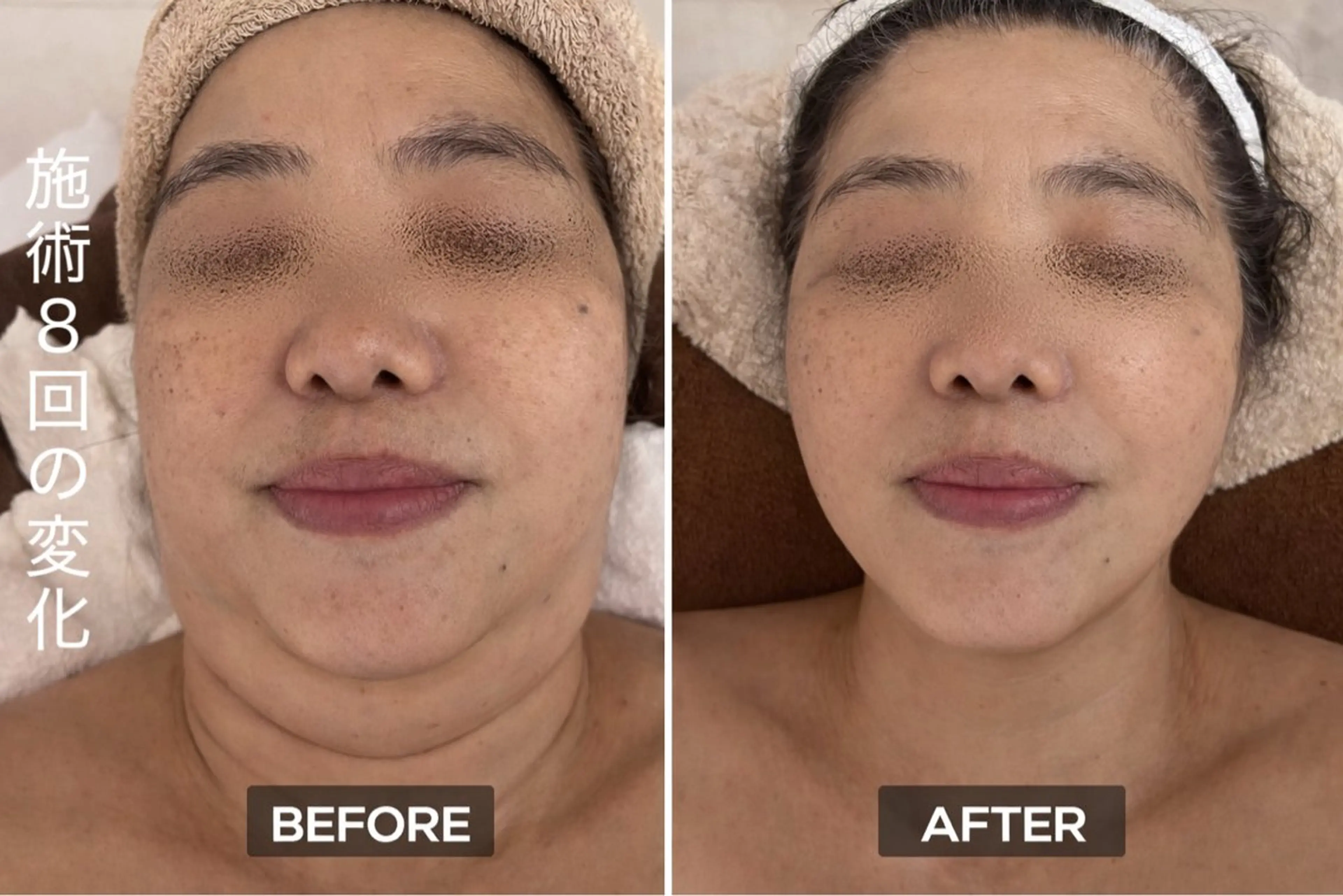 【歴13年】劇的小顔 D rマジックタッチのエステ・リラクイメージ