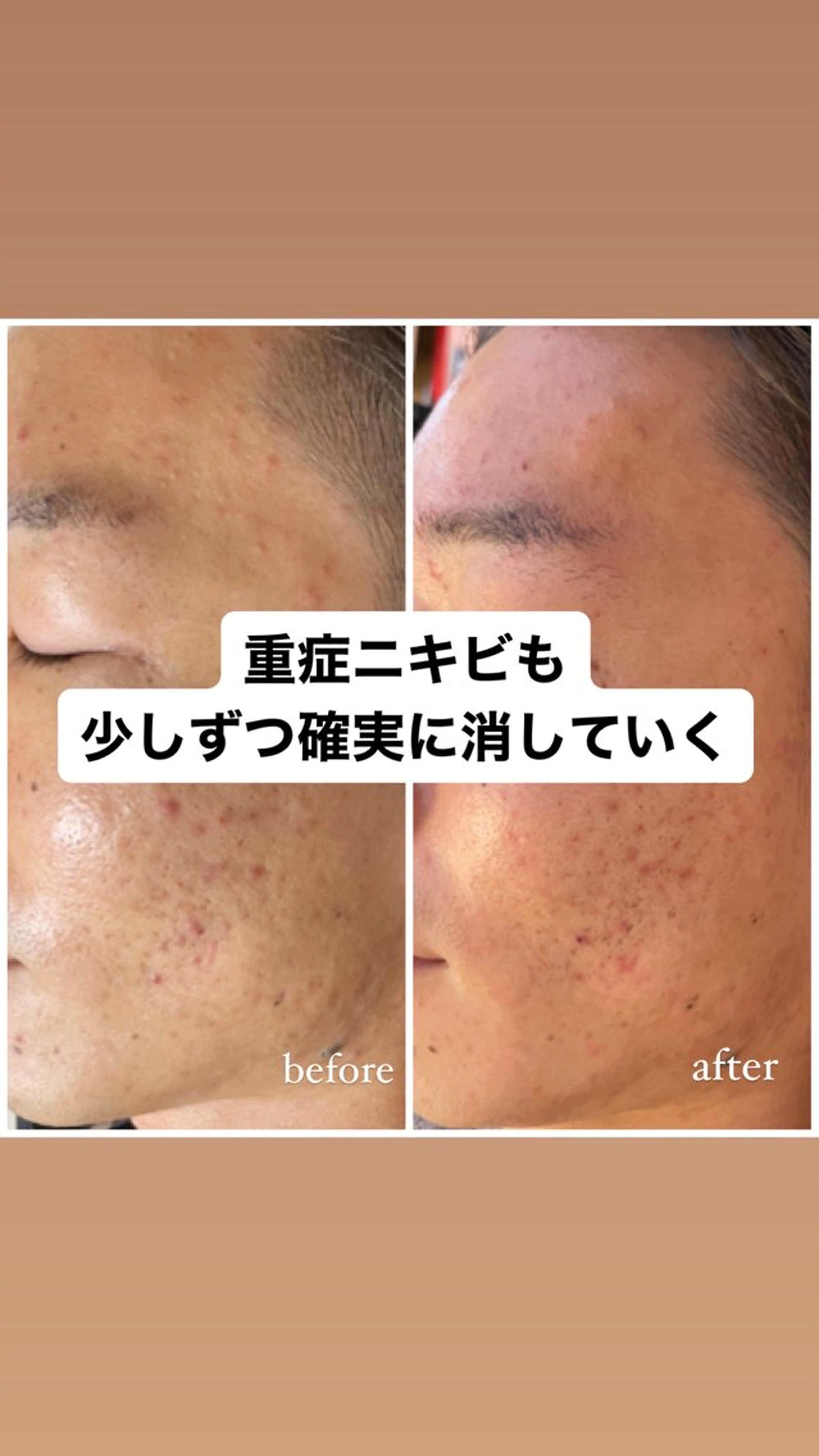 919private salon所属・919 AMIのエステ・リラクイメージ