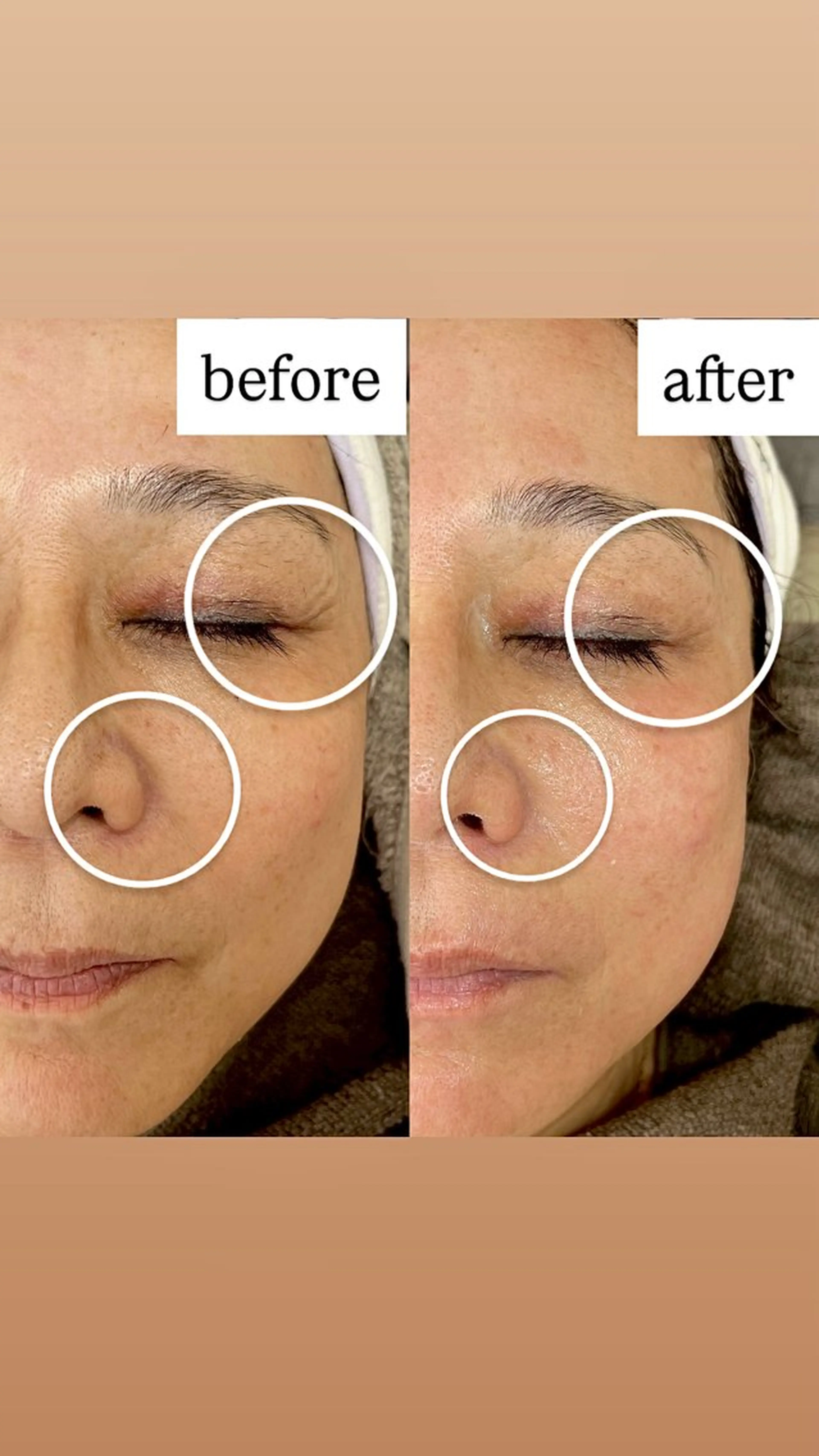 脱毛 iti 眉毛とワックス脱毛の眉毛・アイブロウイメージ