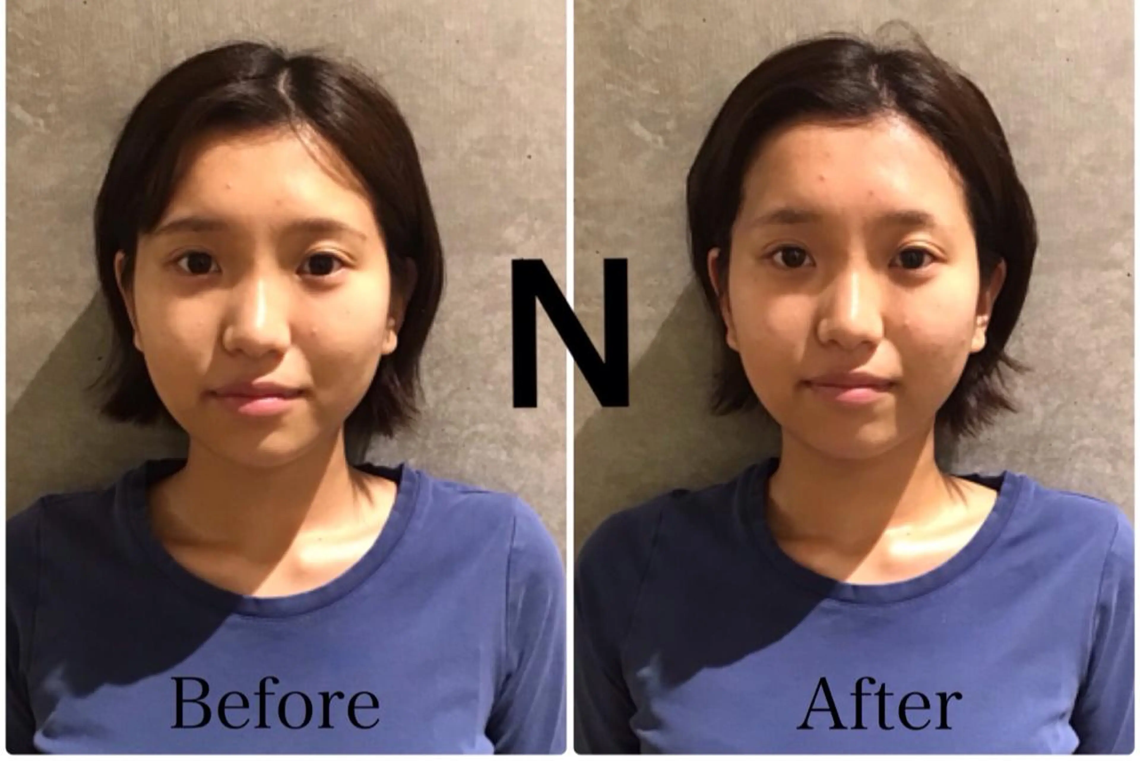 エステ リラク 目黒/小顔/矯正 美容整体師テツロウのエステ・リラクイメージ