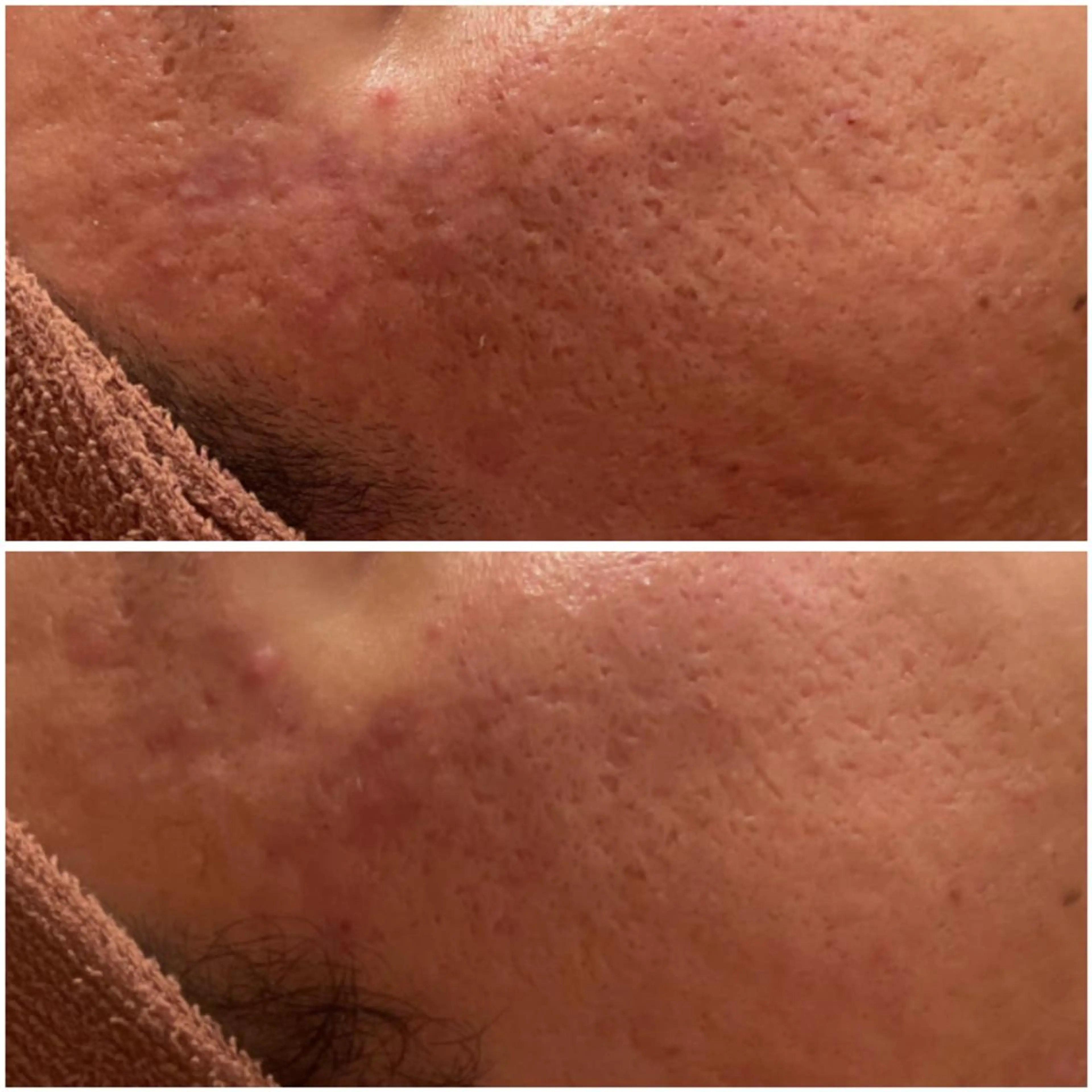 エステ リラク ニキビ・肌質改善専門 ♡人生が変わるサロンのエステ・リラクイメージ