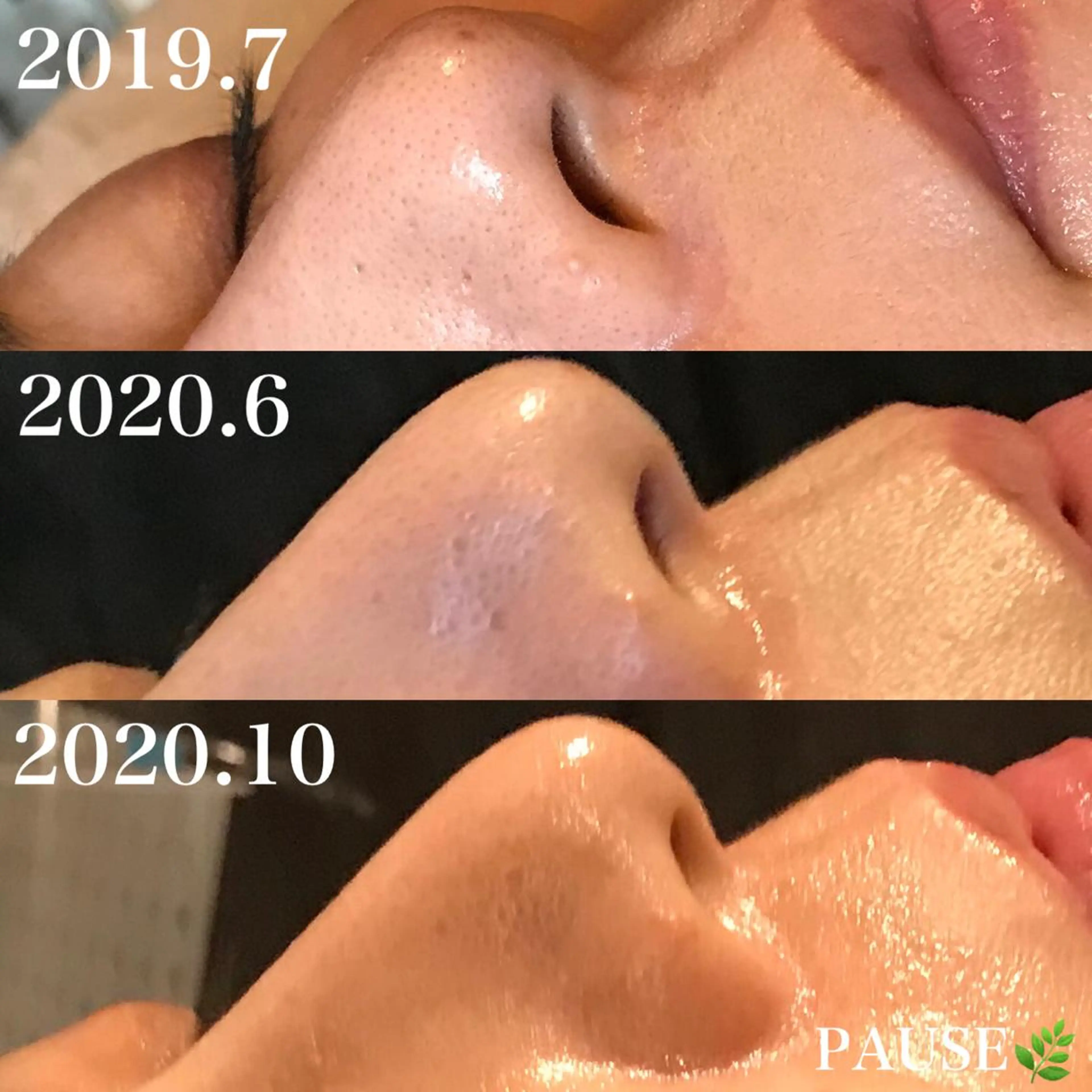 エステ 浜野 恵美のエステ・リラクイメージ