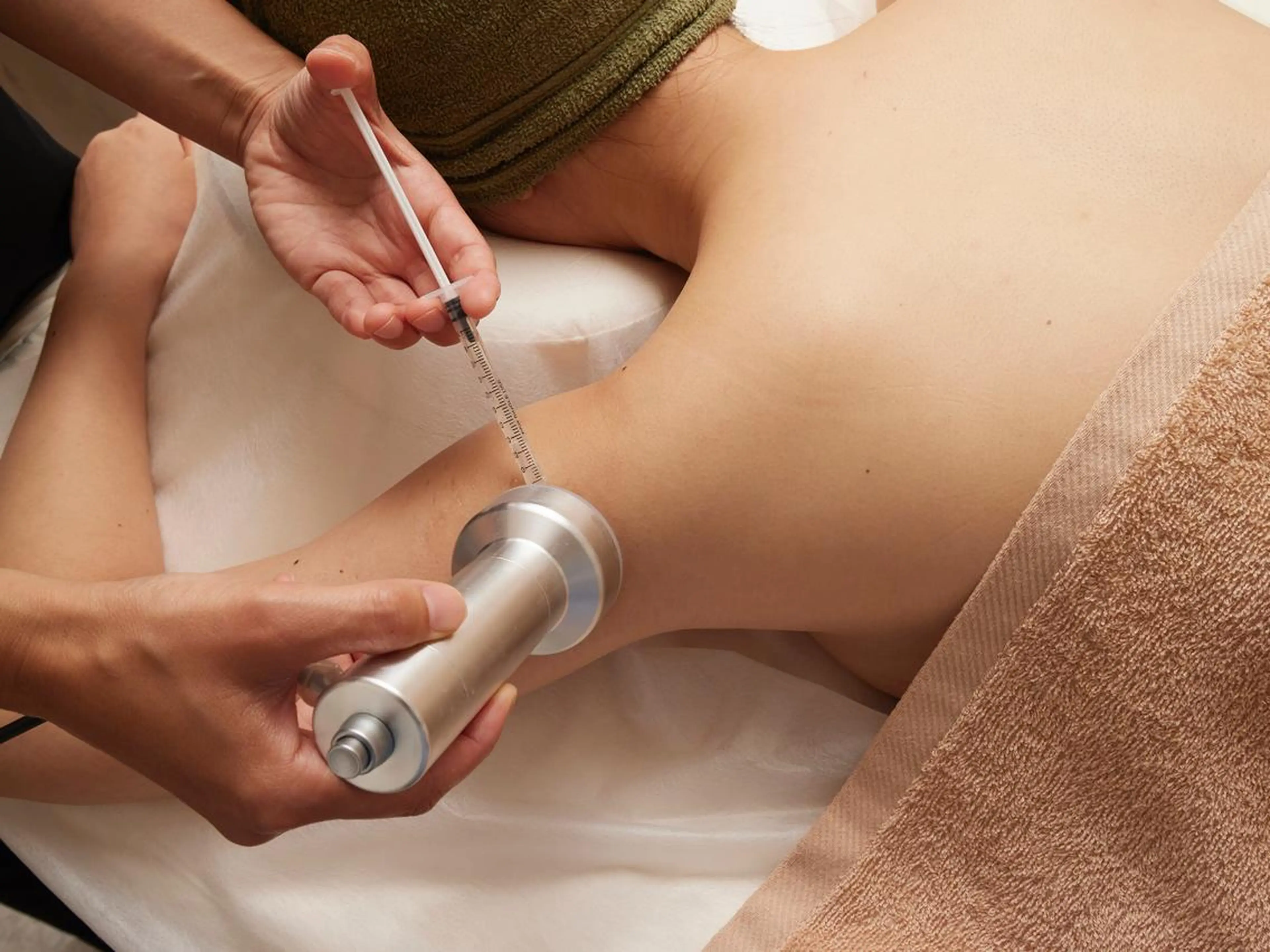 🌿2回目/3回目の方限定🌿針を使わない脂肪撃退【お顔】の写真