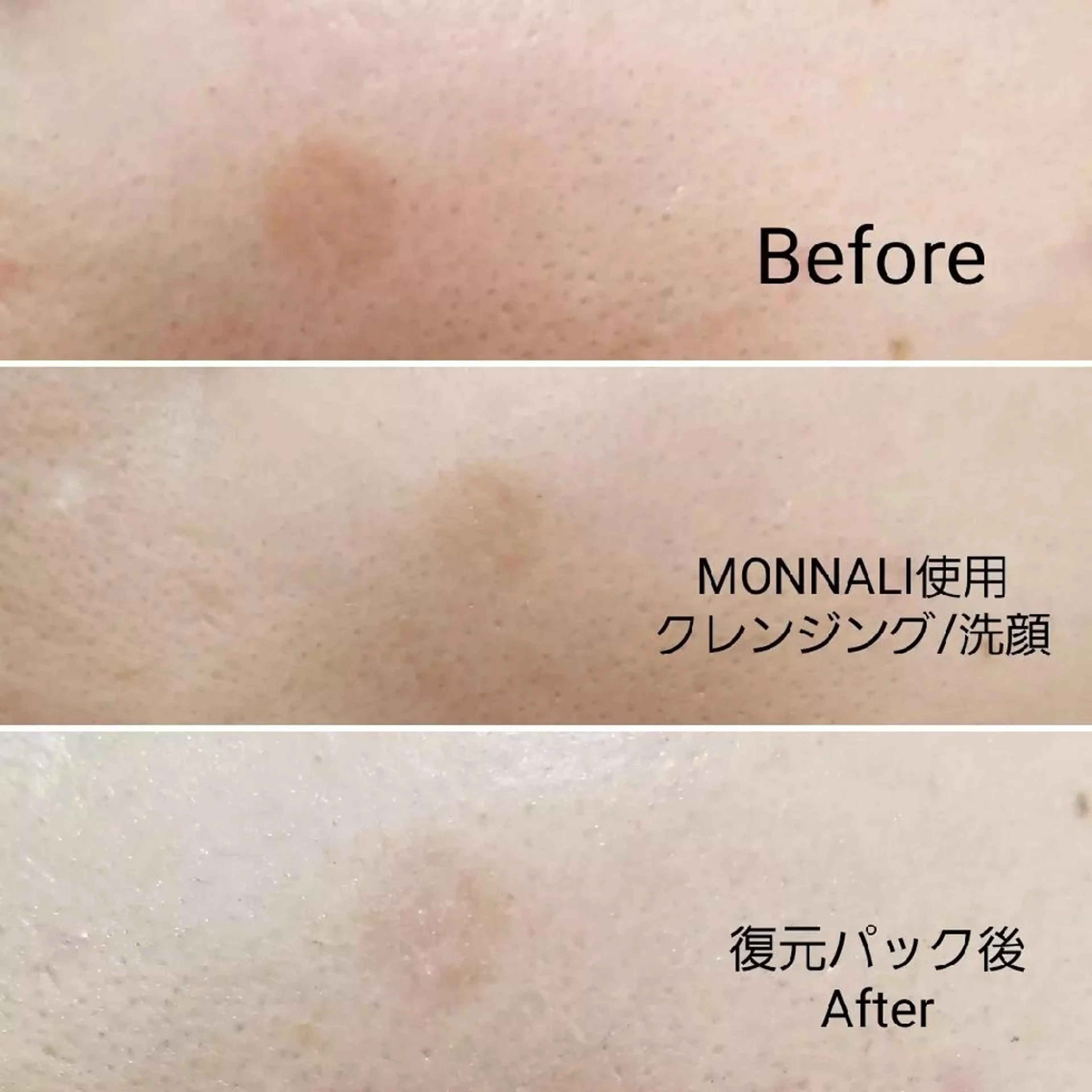 Anacia Beauty Salon所属・美肌脱毛&毛穴専門 Anaciaのエステ・リラクイメージ