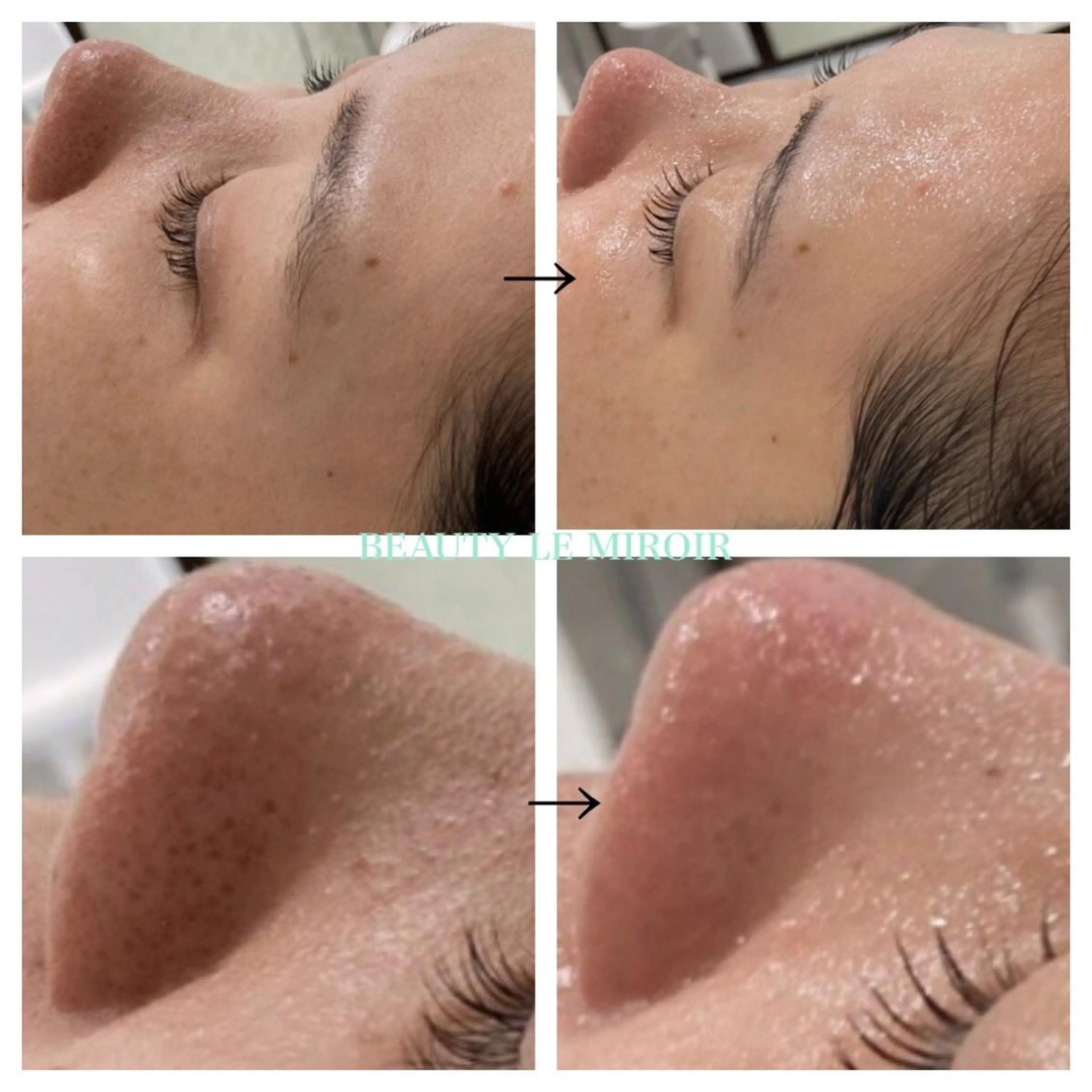 ビューティー ミロワールのエステ・リラクイメージ