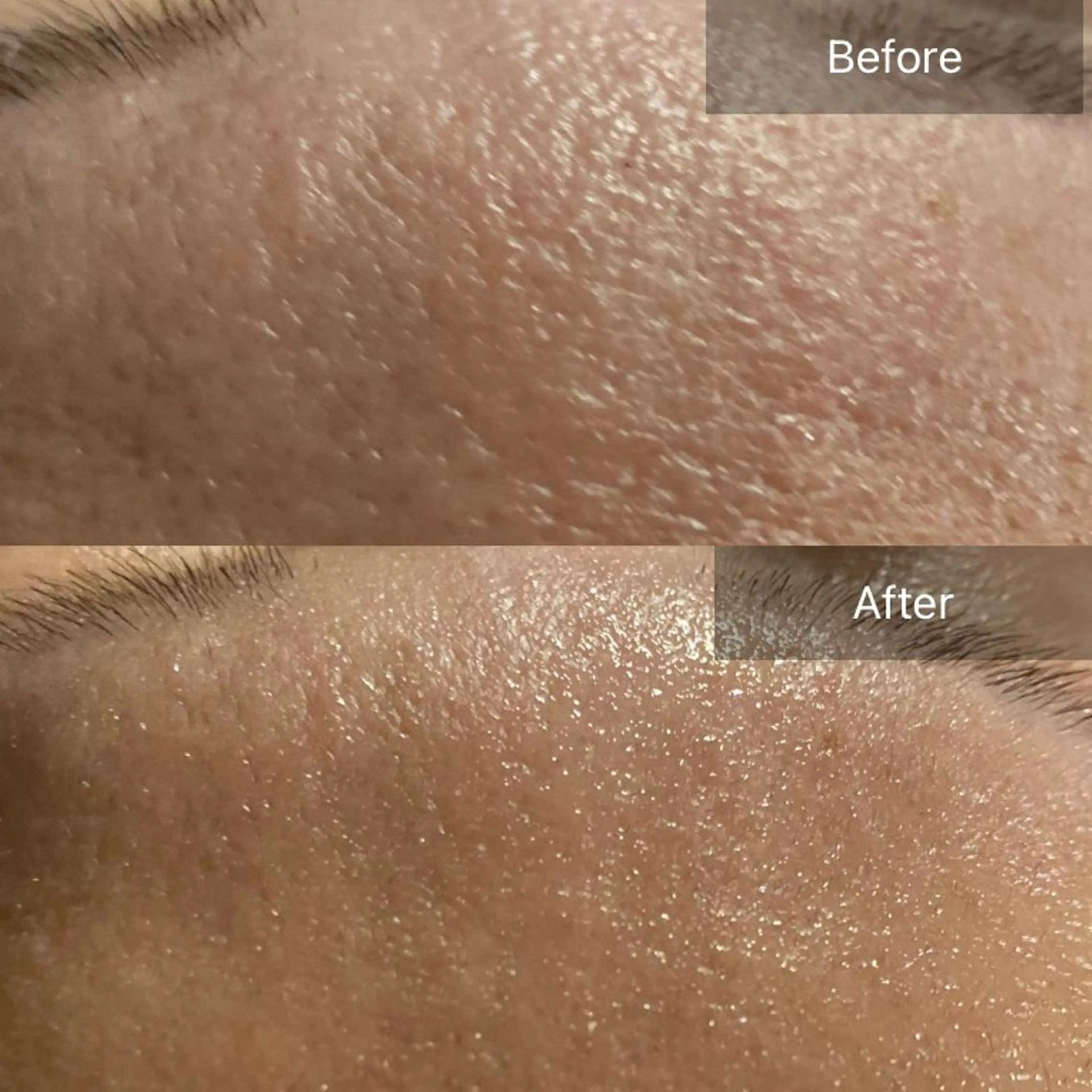 Mandarin Orange所属・毛穴から始める肌メン テマンダリンオレンジのエステ・リラクイメージ