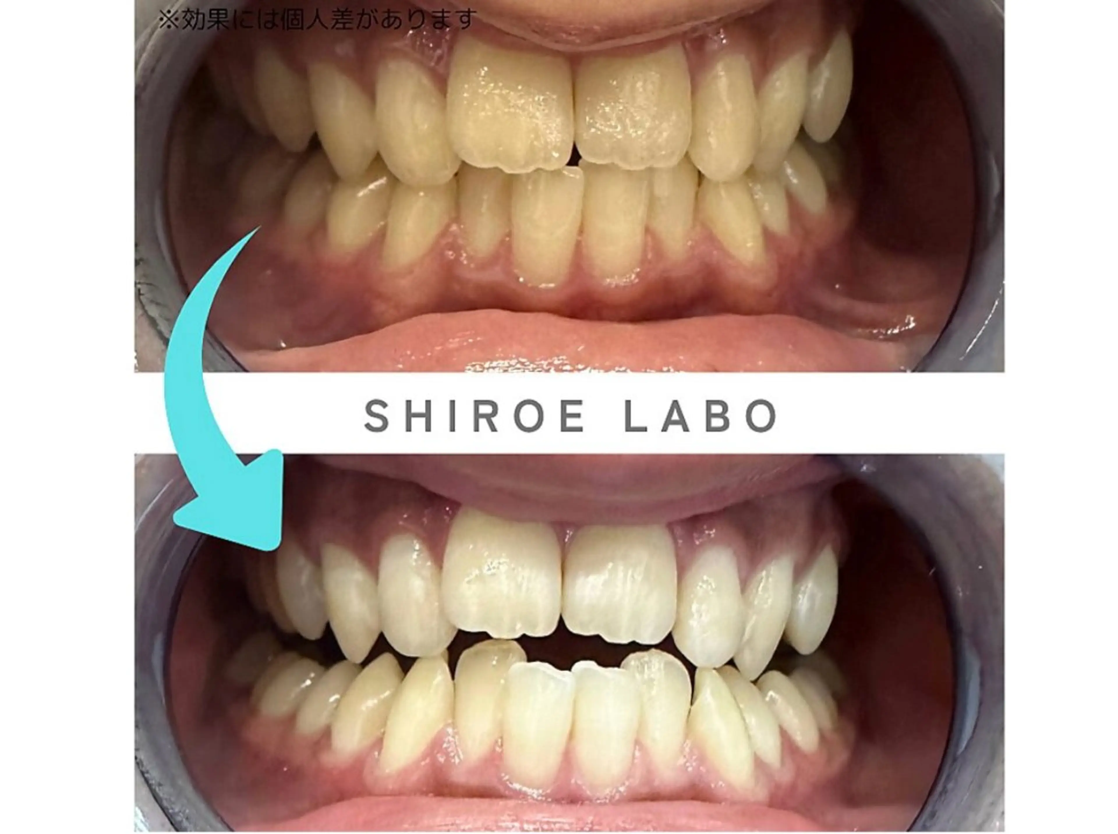 【歯のホワイトニング専門店】シロエラボ梅田店所属・シロエラボ 梅田店のその他イメージ