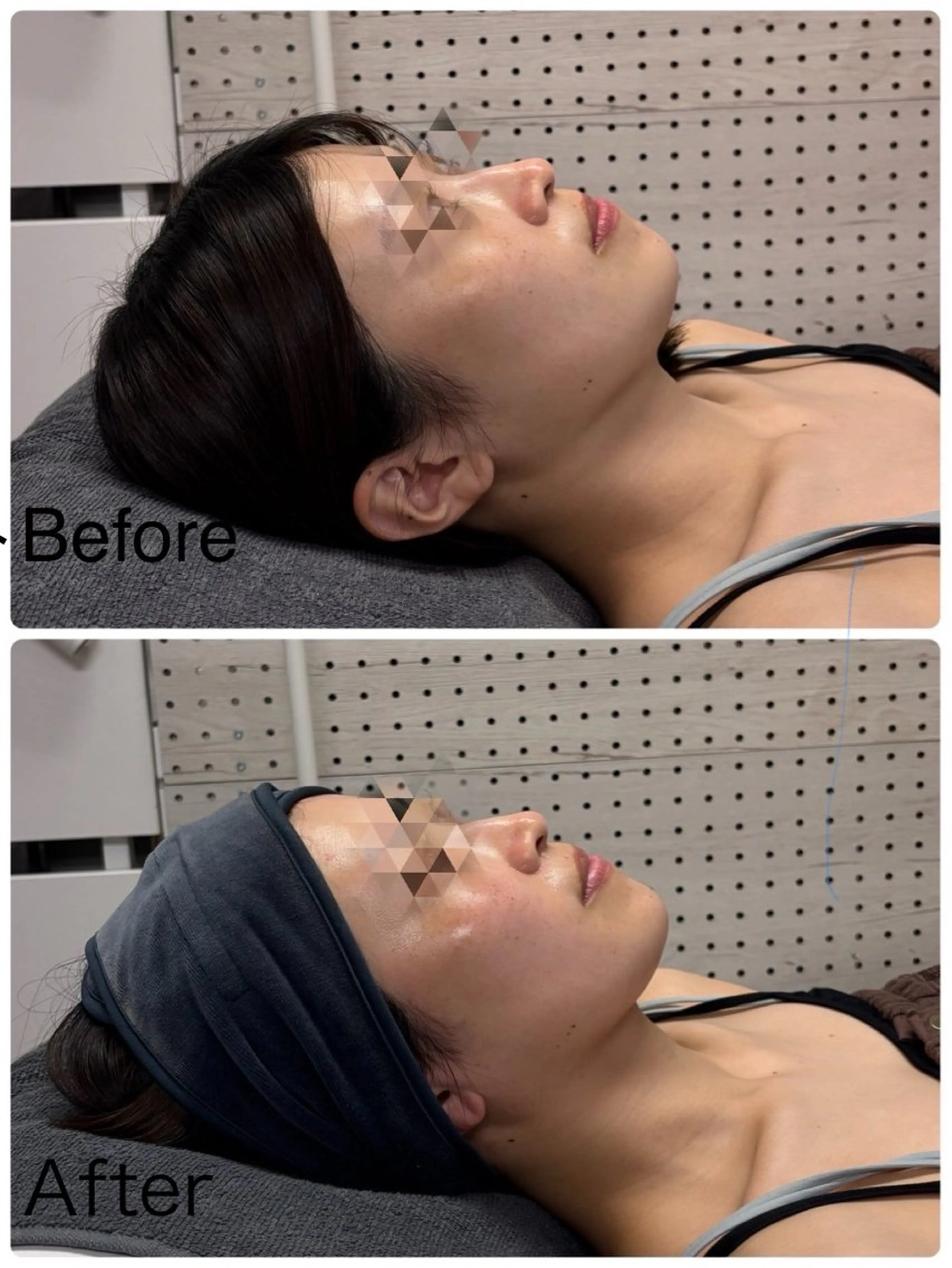 エステ tomo Sのその他イメージ