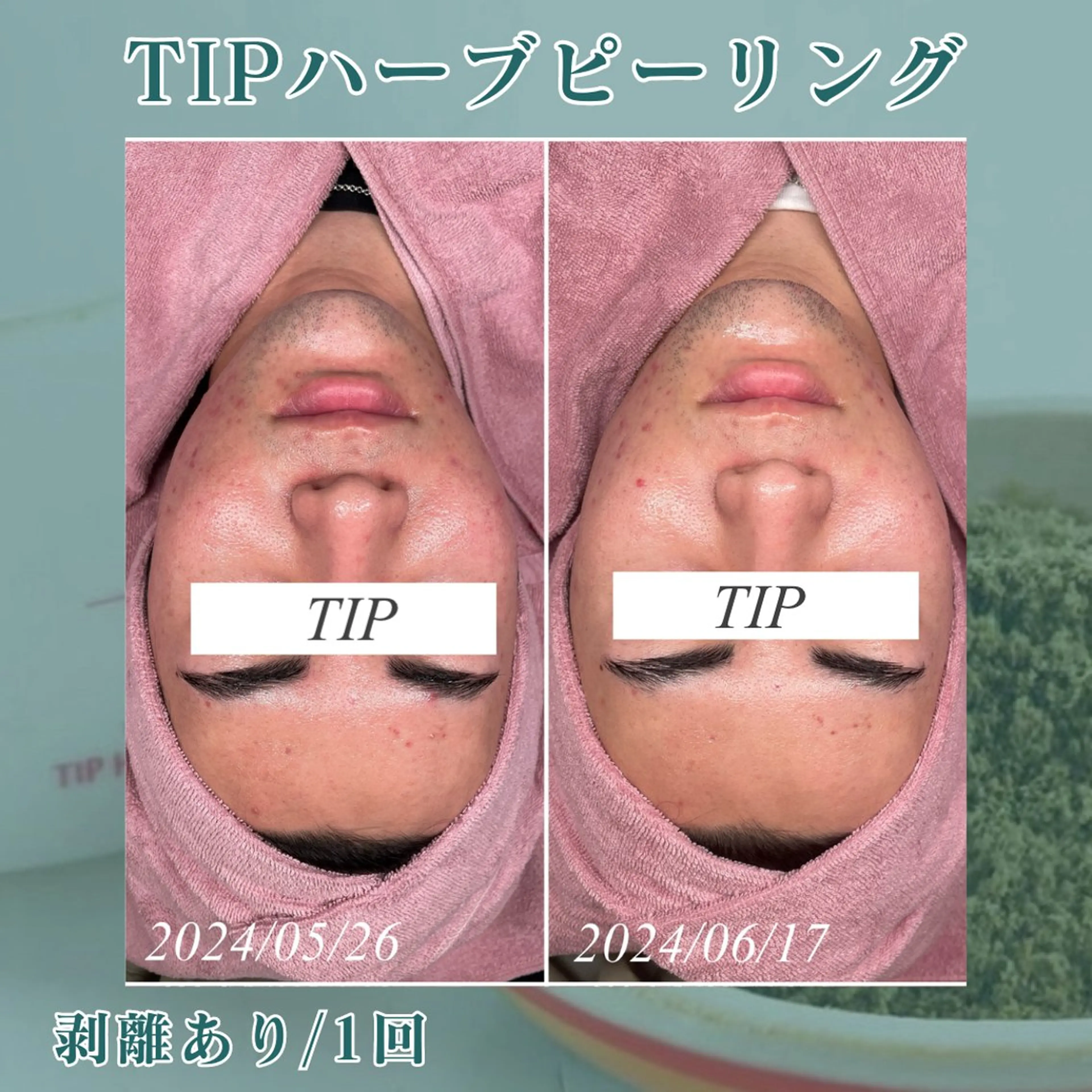 メンズ skin salon en所属・skin salon enのエステ・リラクイメージ