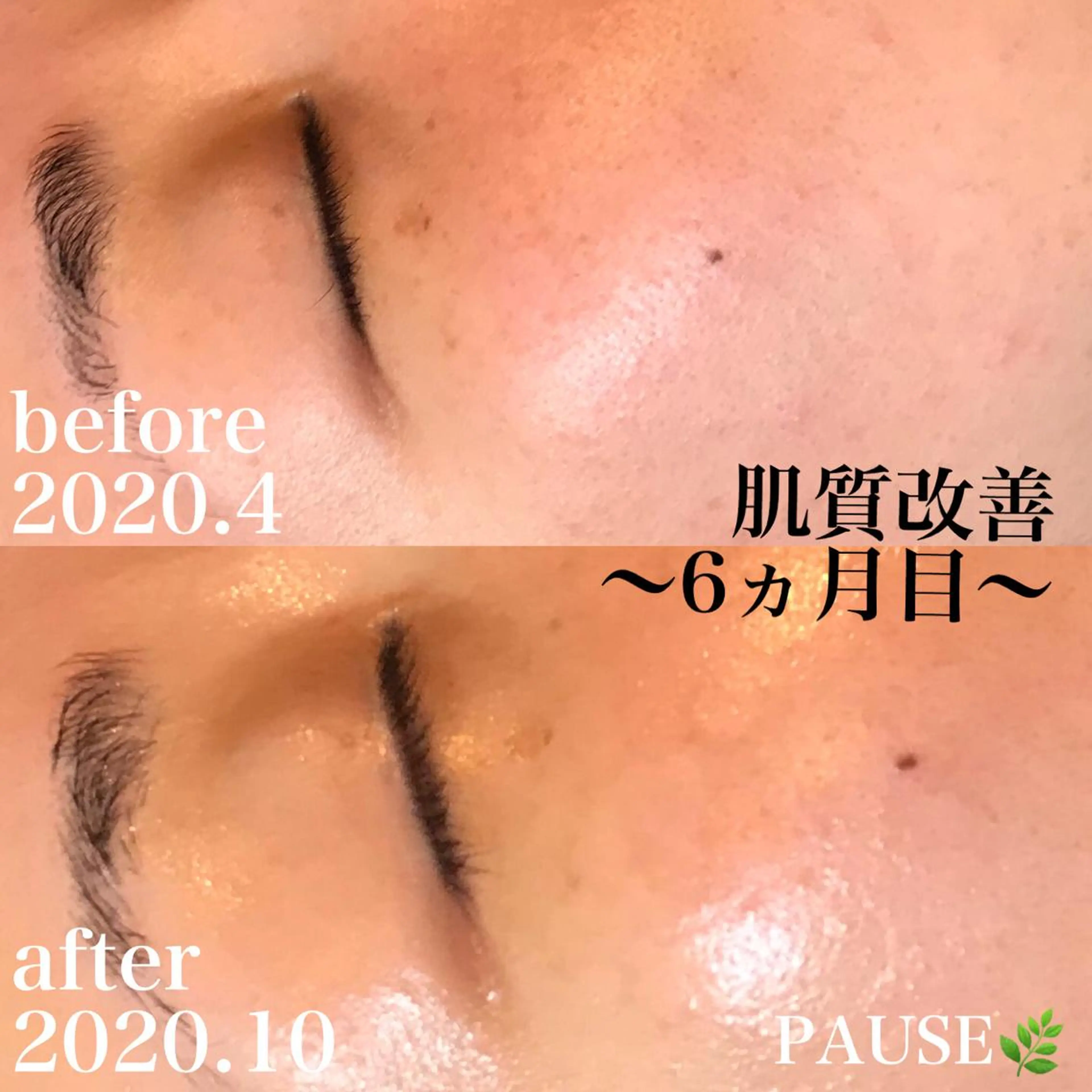 エステ 浜野 恵美のエステ・リラクイメージ