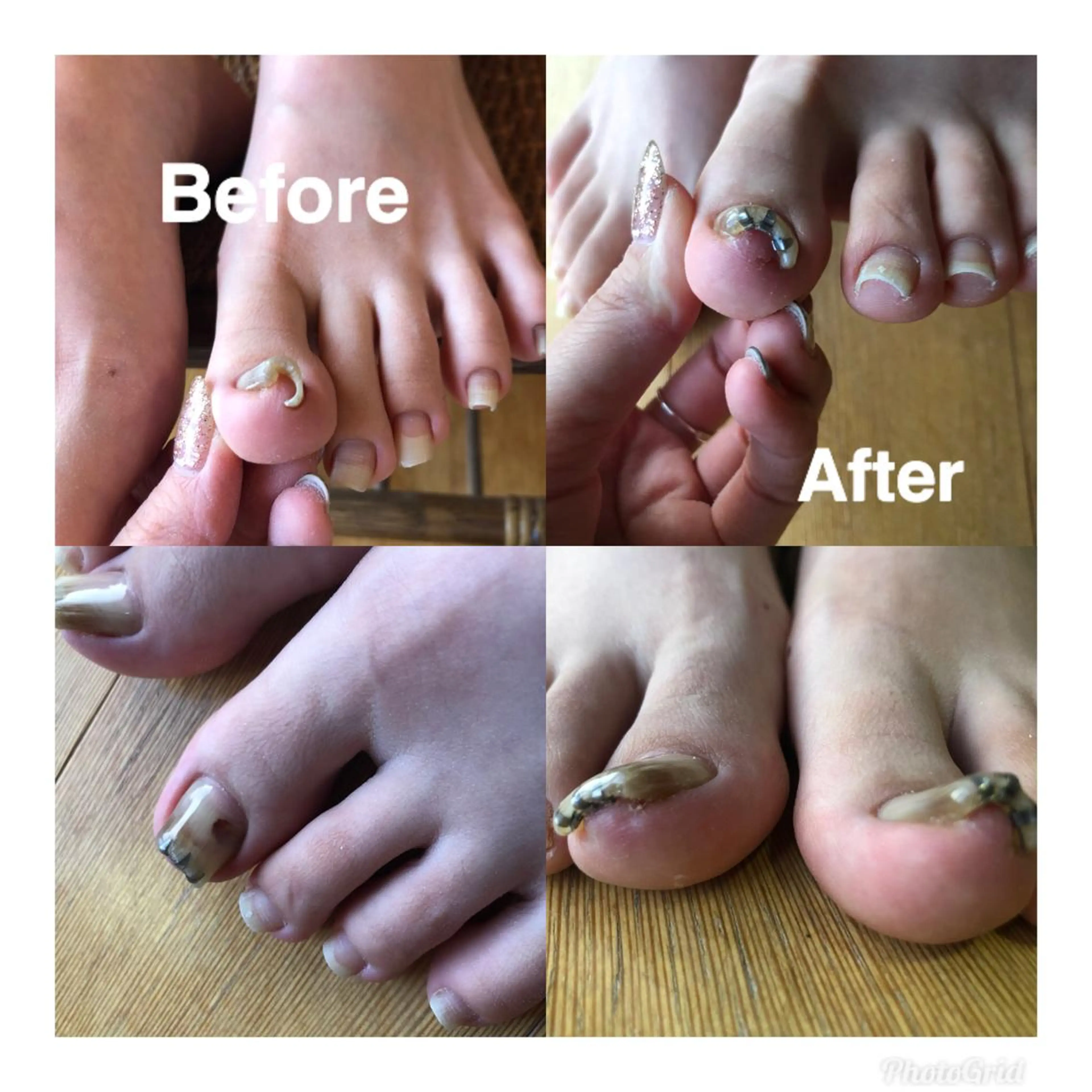 ネイル アートネイル LINON所属・【LINON】 airiのネイルデザイン