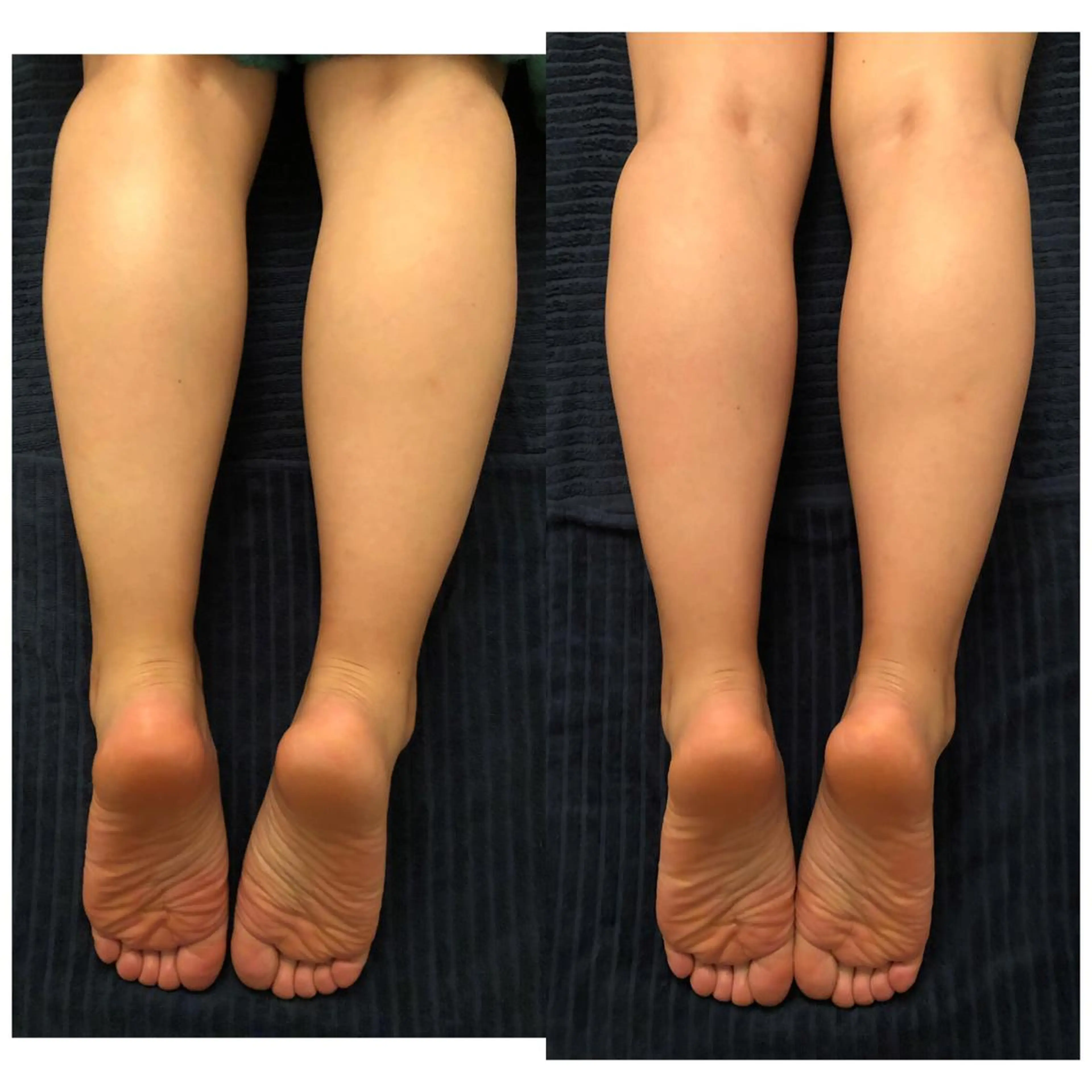 エステ リラク おうちサロン B-ROOMのエステ・リラクイメージ