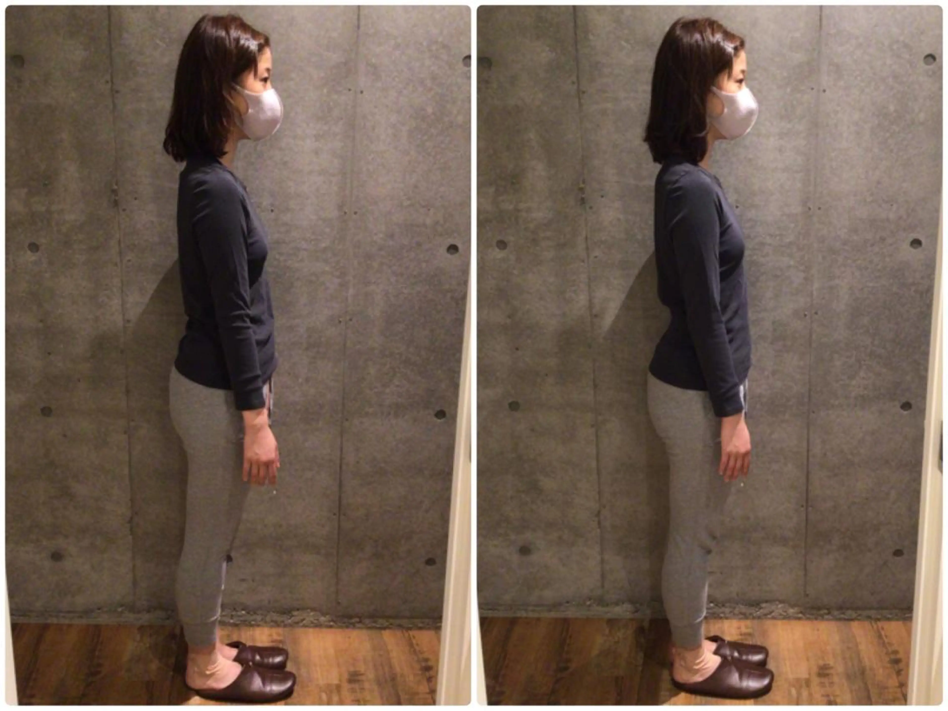 目黒/小顔/骨盤/ 美容鍼/美顔鍼/小林のエステ・リラクイメージ