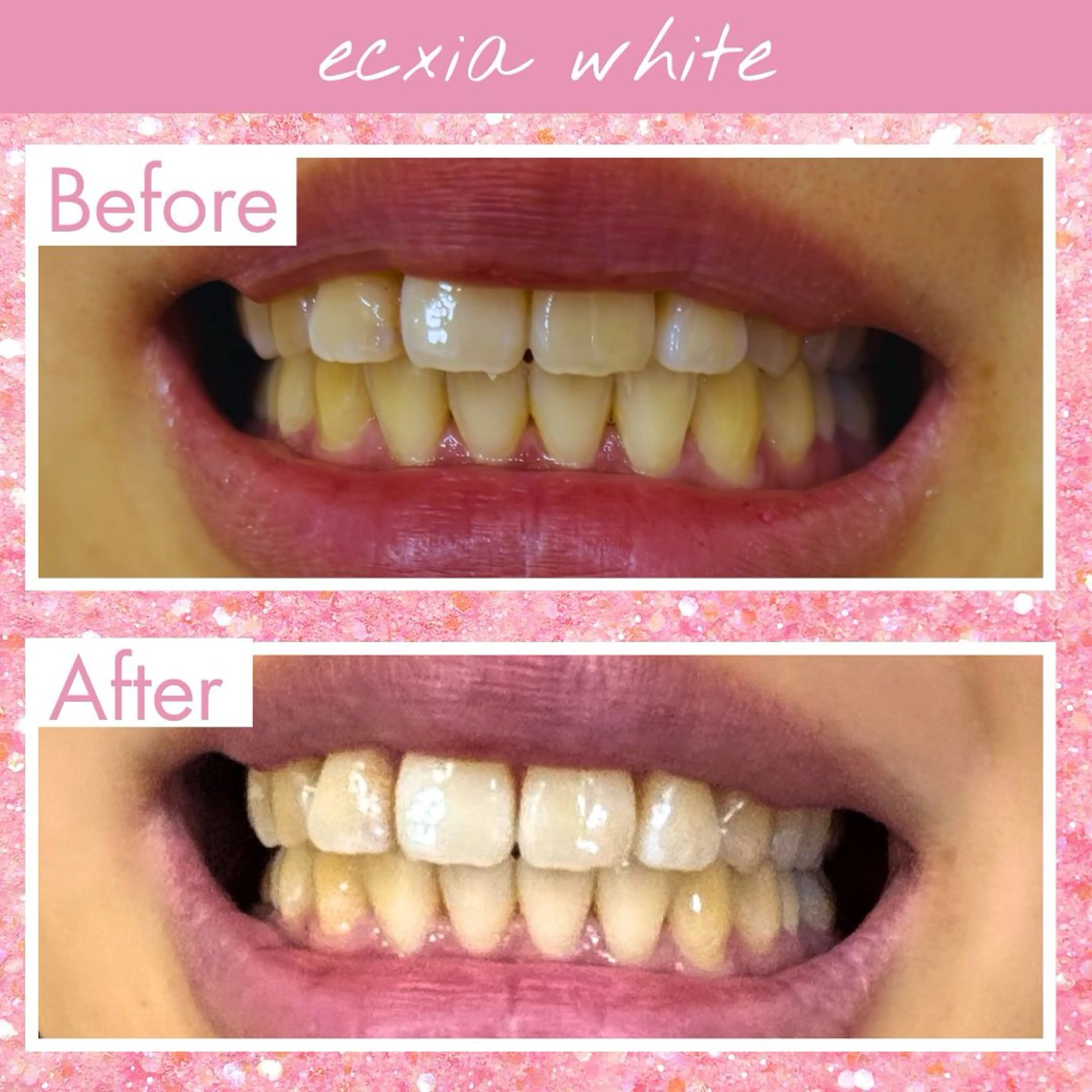 セルフホワイトニング エクシア戸田公園店所属・セルフホワイトニング エクシア戸田公園店のその他イメージ