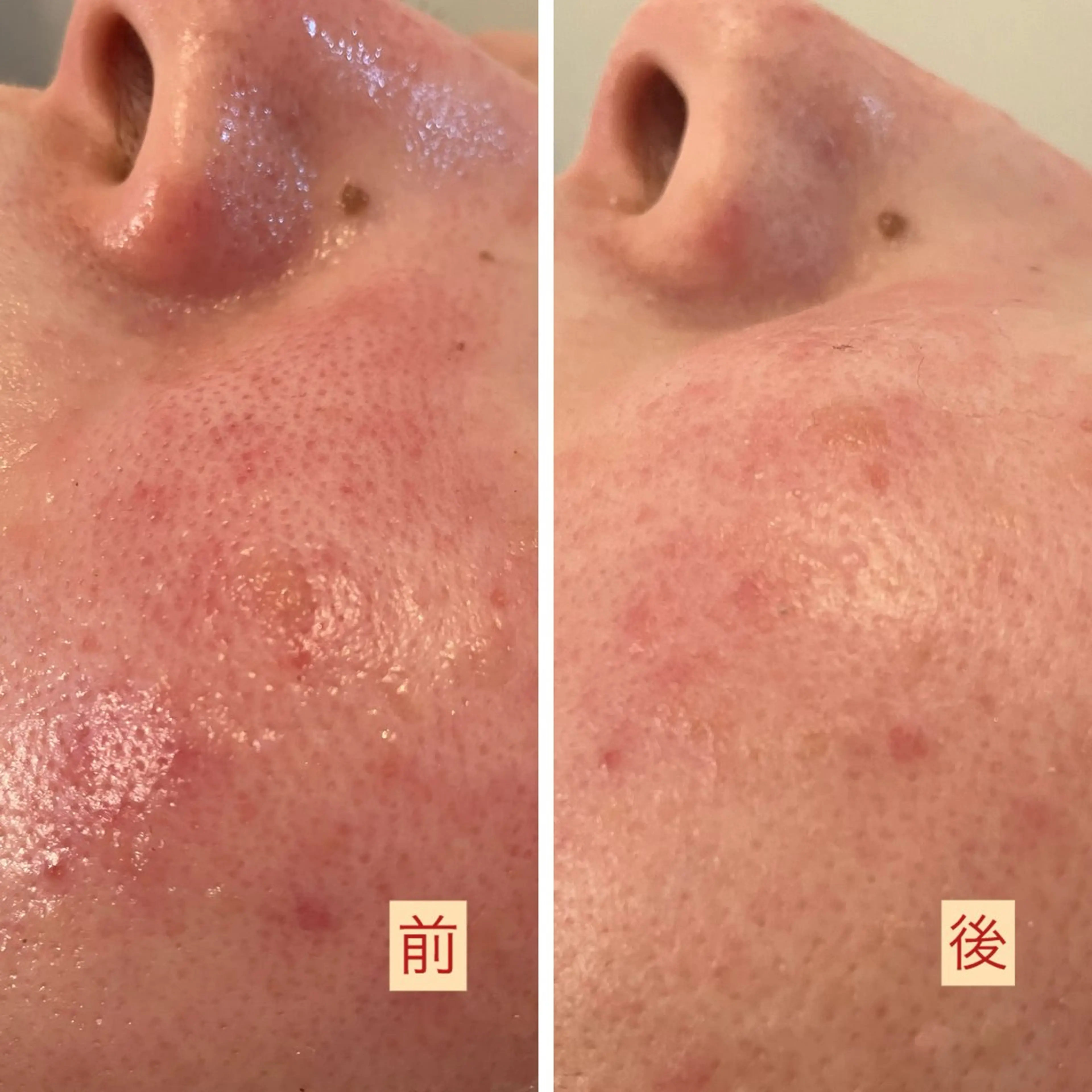 その他 たるみ改善小顔エステ 堀葉月のその他イメージ