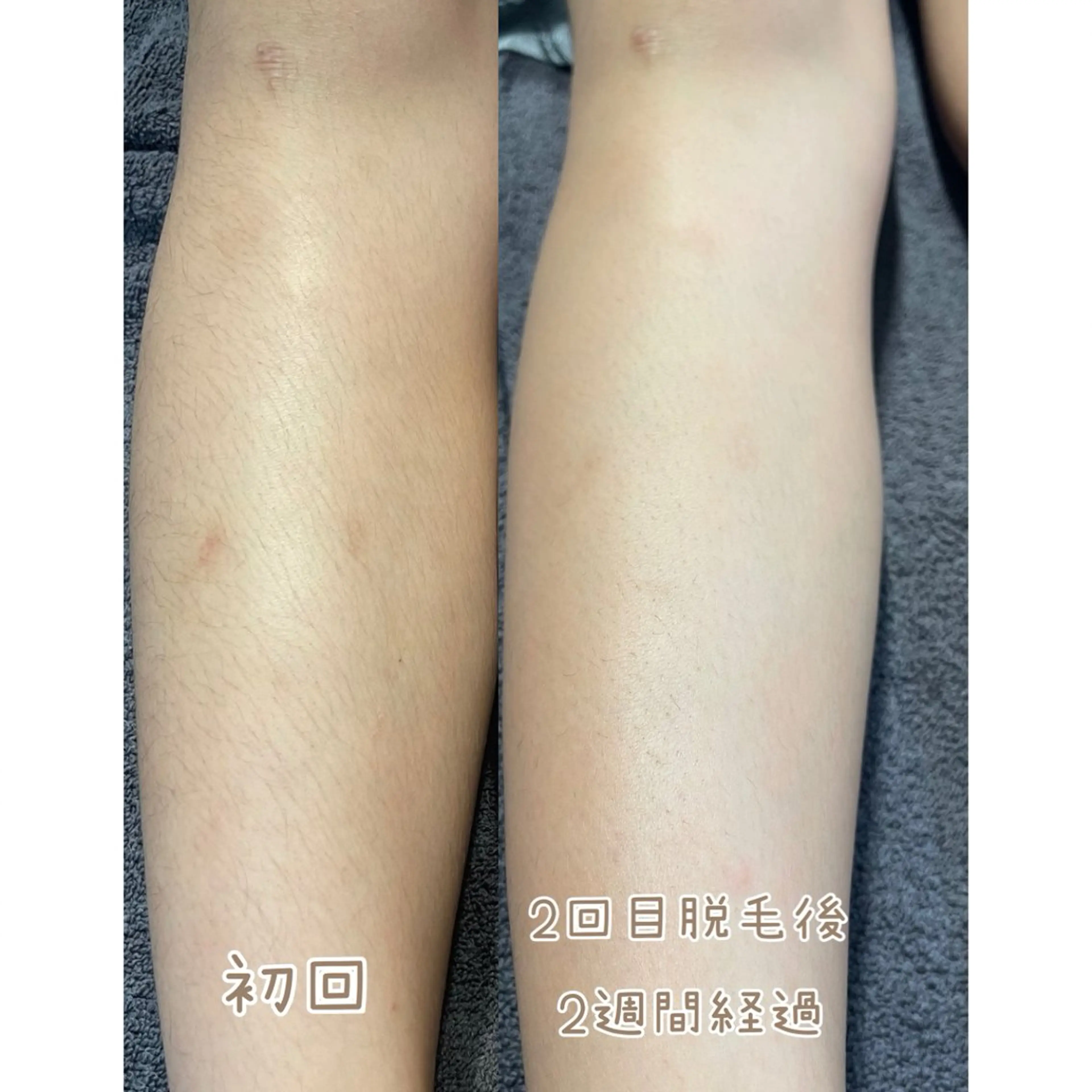 脱毛 Beauty Salon   Cherir～シェリール～所属・SUZUKI ～Cherir～のエステ・リラクイメージ