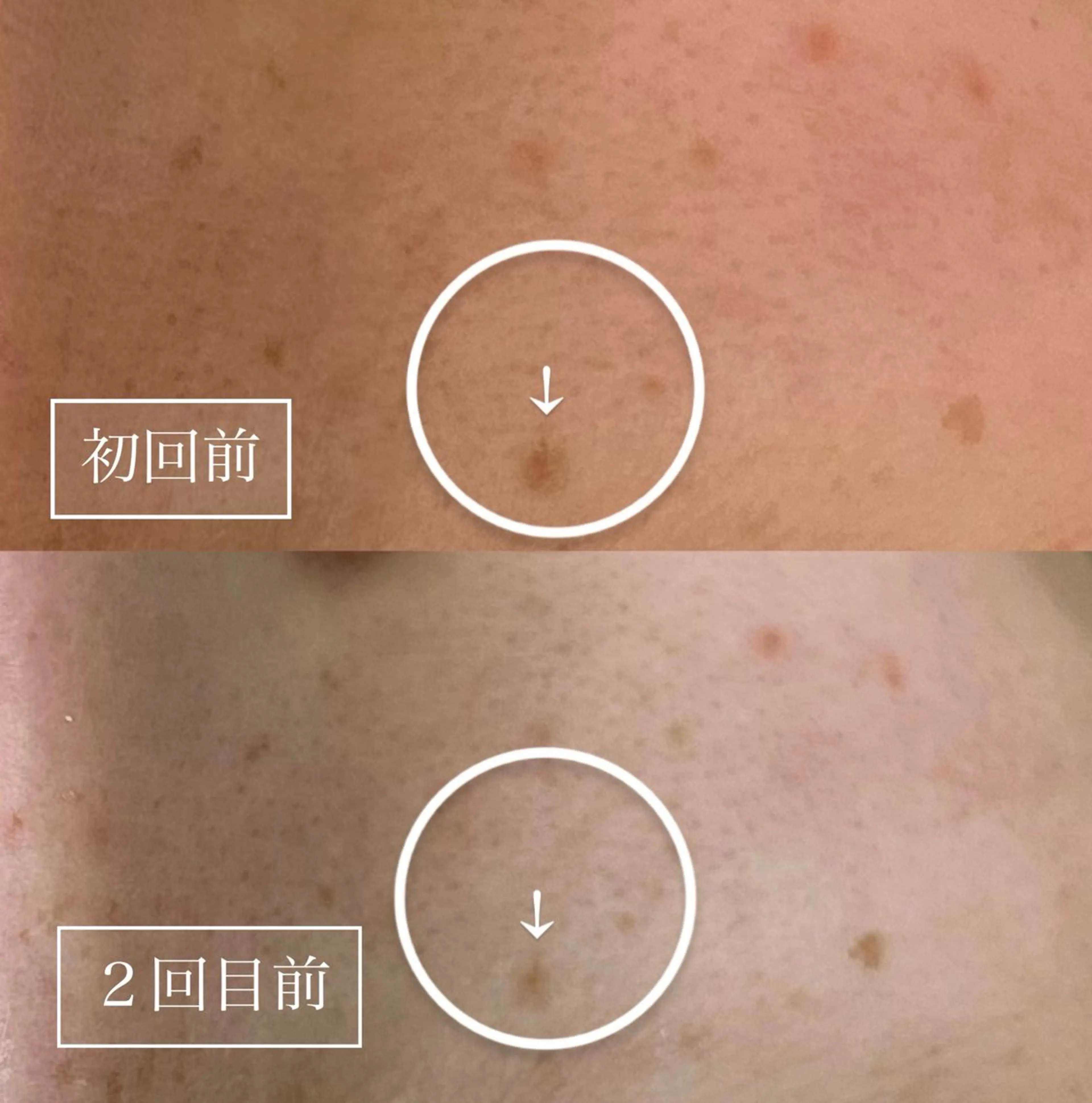 LUMY GRATiAEのエステ・リラクイメージ