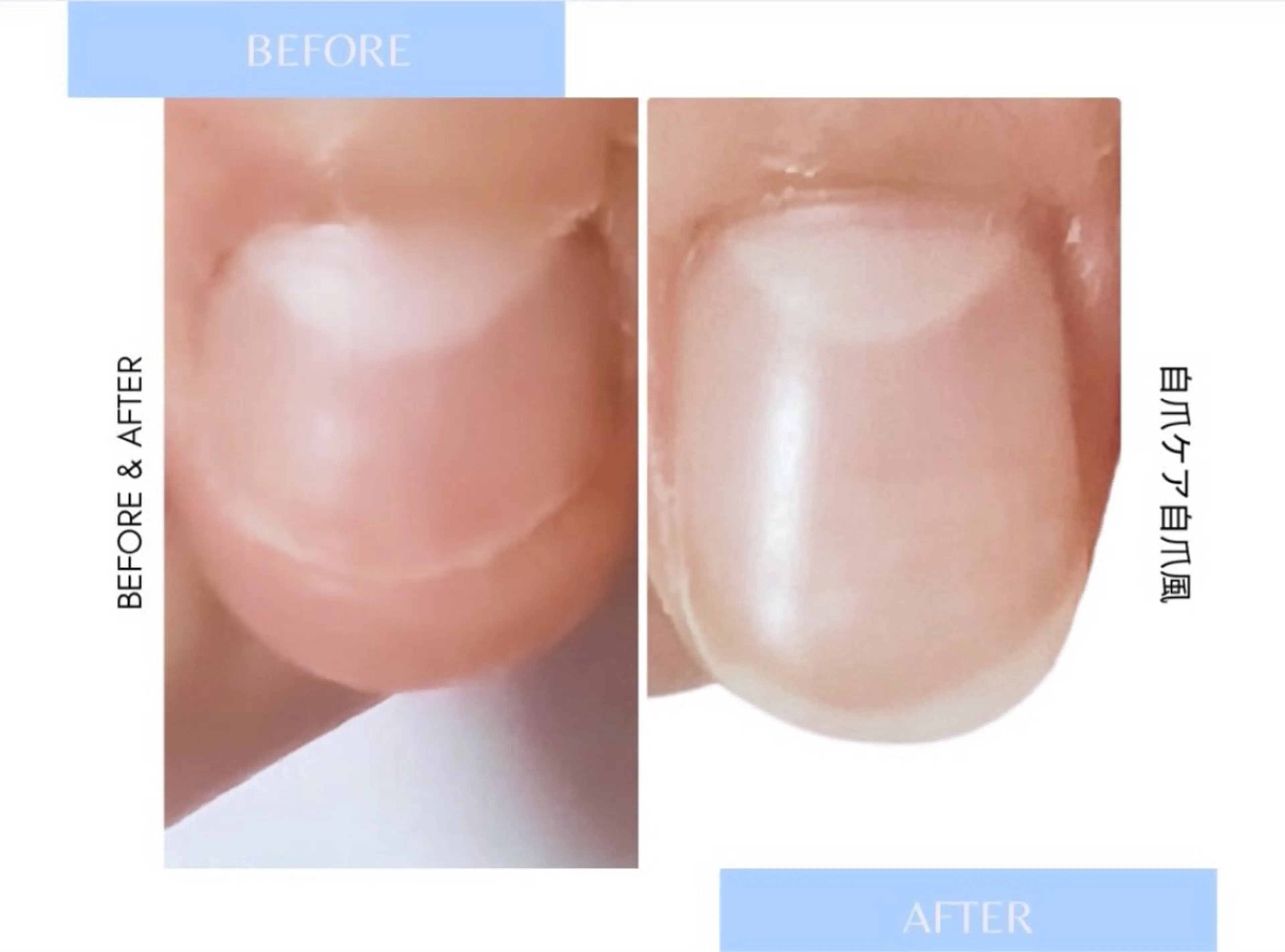 自爪ケア【当日限定/初回】深爪自爪を伸ばしたい方/自爪育成/ジェルネイルで補強/クリアor自爪風※長さ出しなしの写真