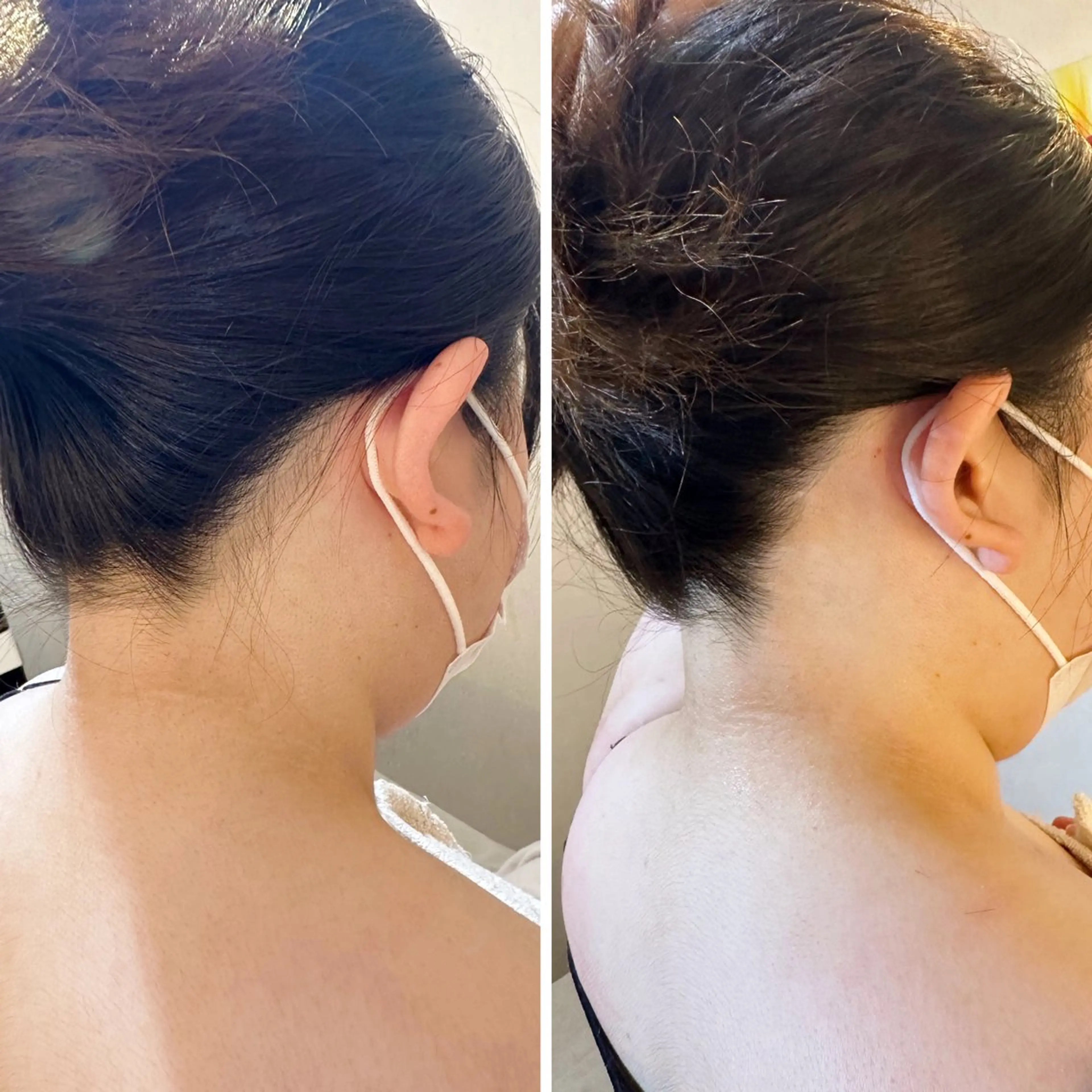 脱毛 うなじ脱毛/美肌脱毛 LABELのエステ・リラクイメージ