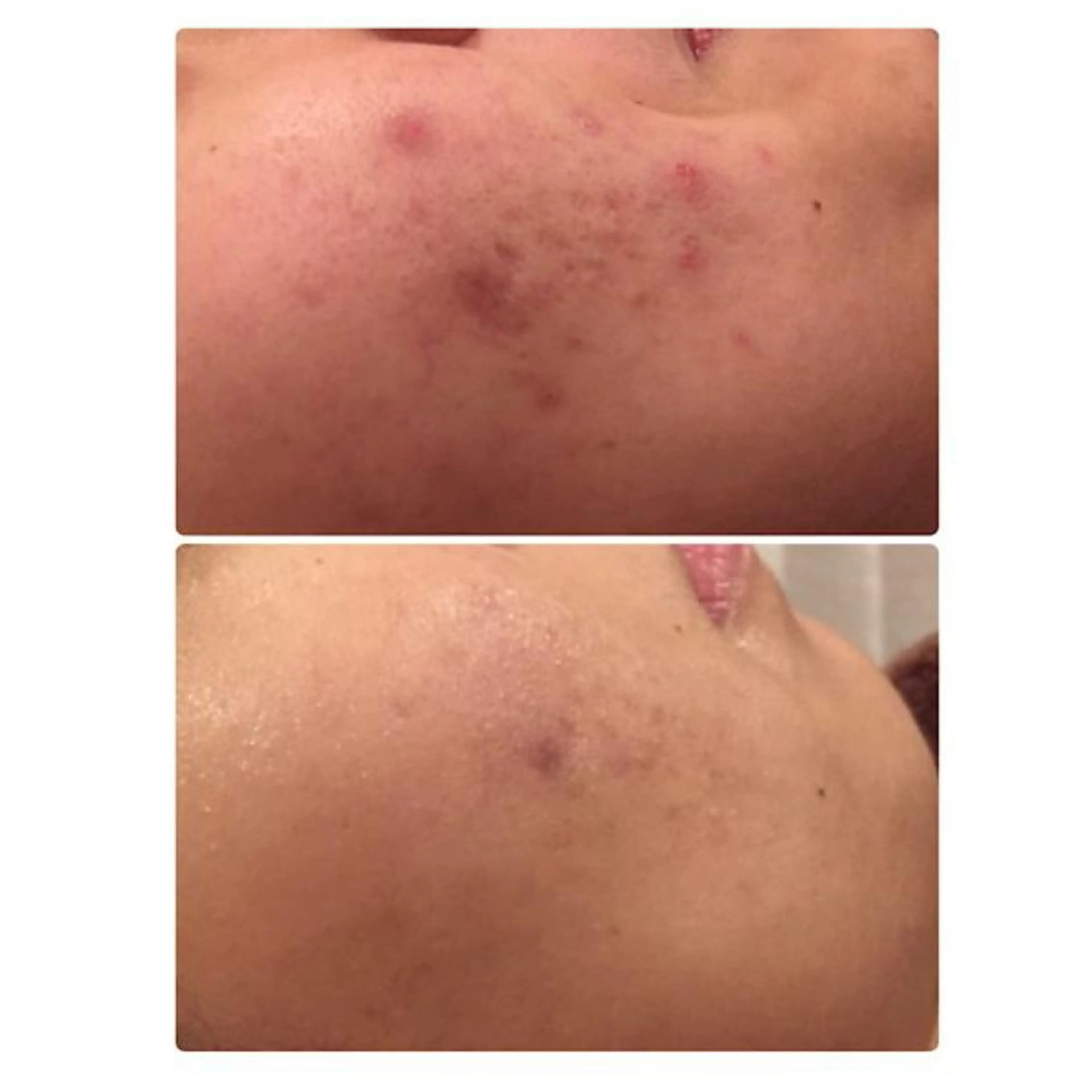 西区九条エステ MITUREIサロンのエステ・リラクイメージ