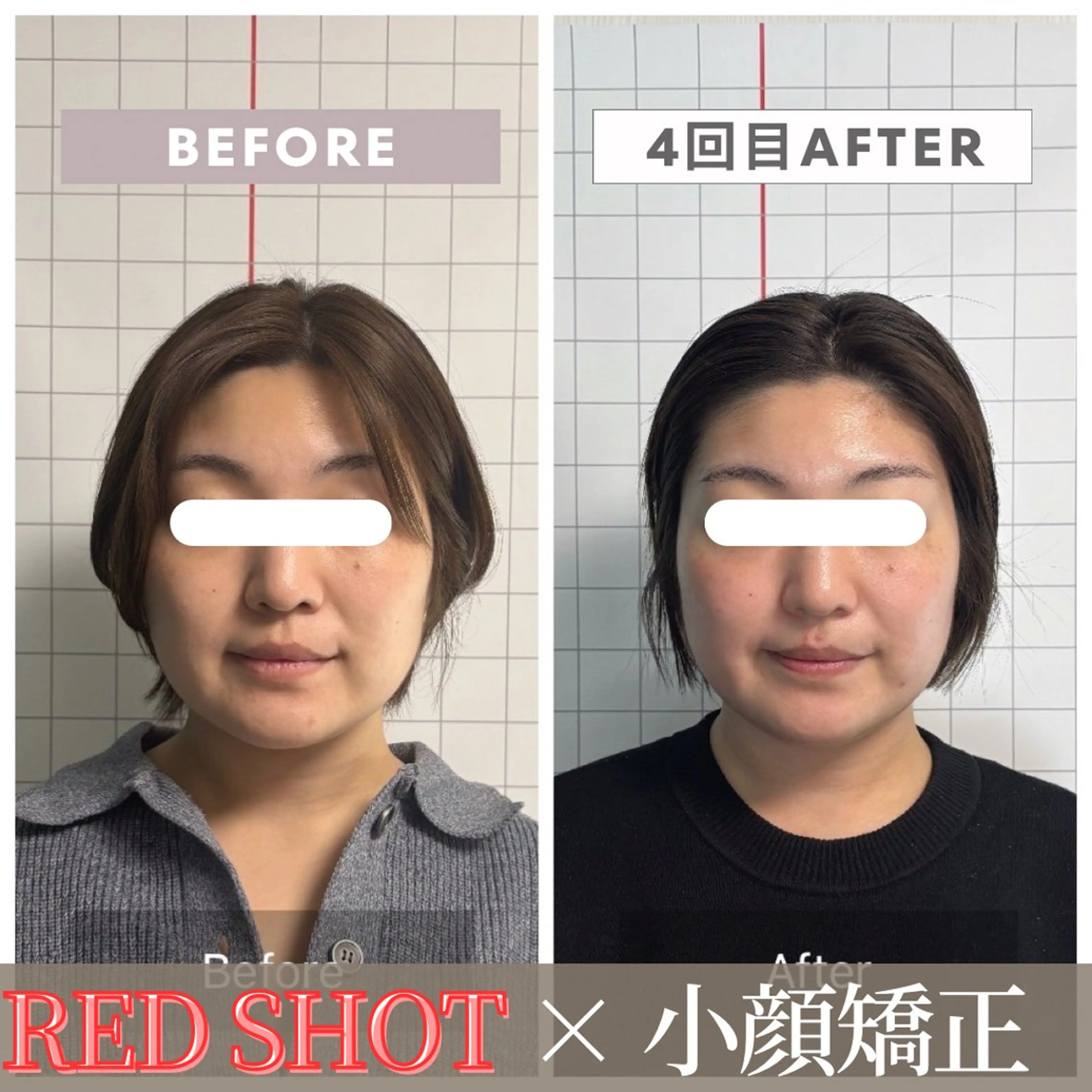 エステ リラク 小顔矯正専門店 【RED】池田のエステ・リラクイメージ