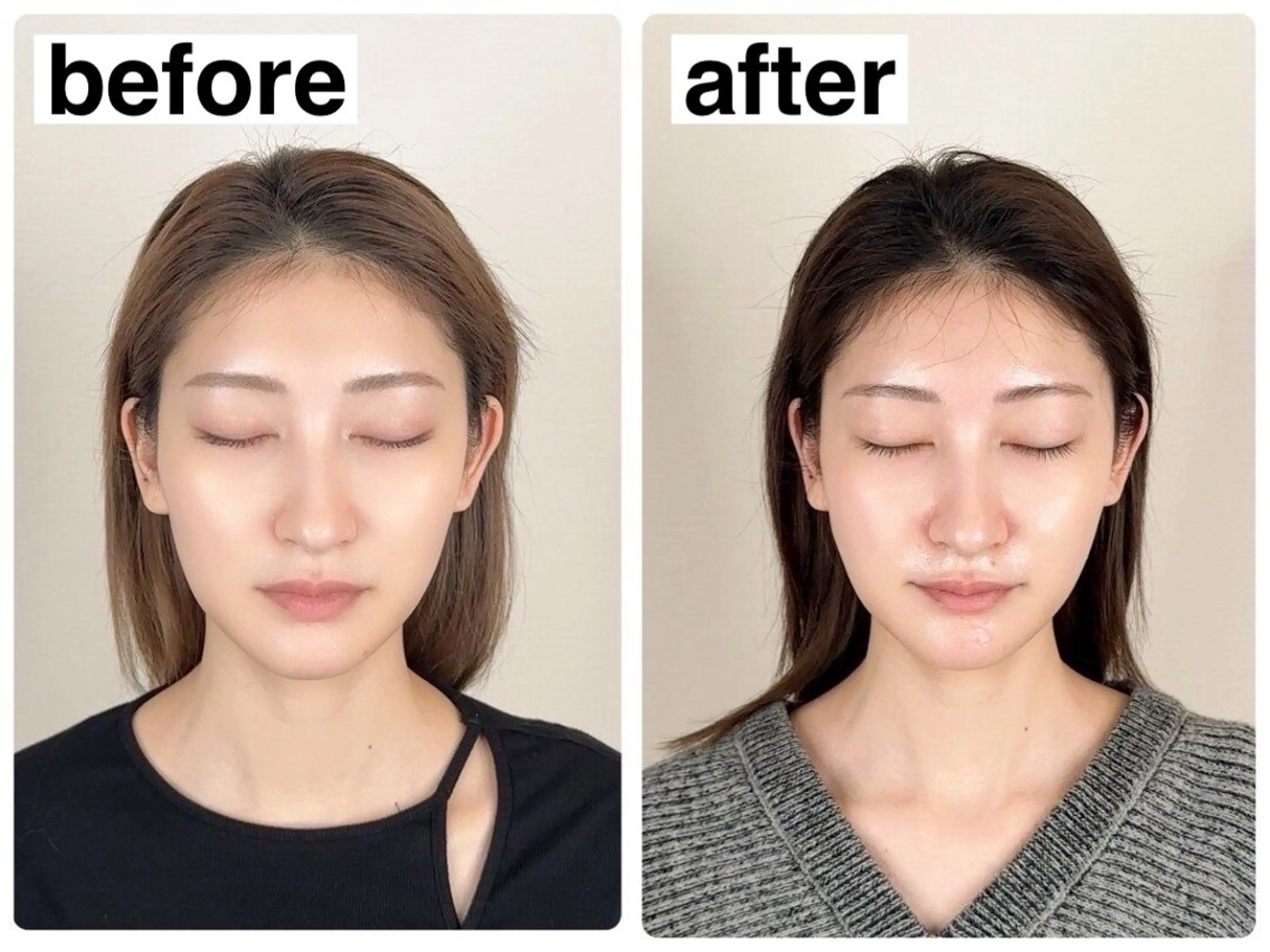 【練習モデルメニュー】【左右差/歪み改善】小顔矯正&頭蓋骨矯正コース¥12,000→¥2,000の写真