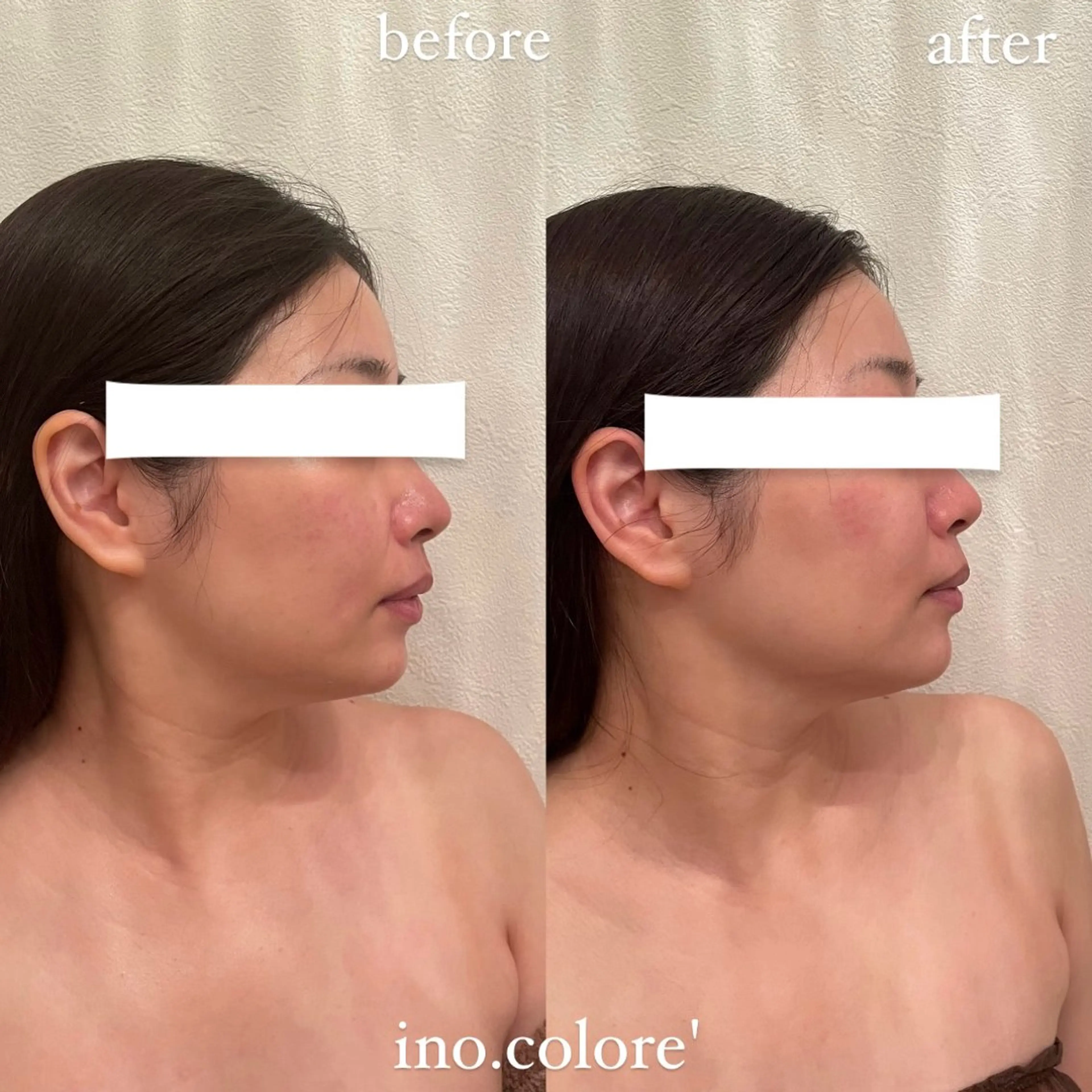 エステ リラク エステサロンino.colore'所属・小顔サロン ino.coloreのエステ・リラクイメージ