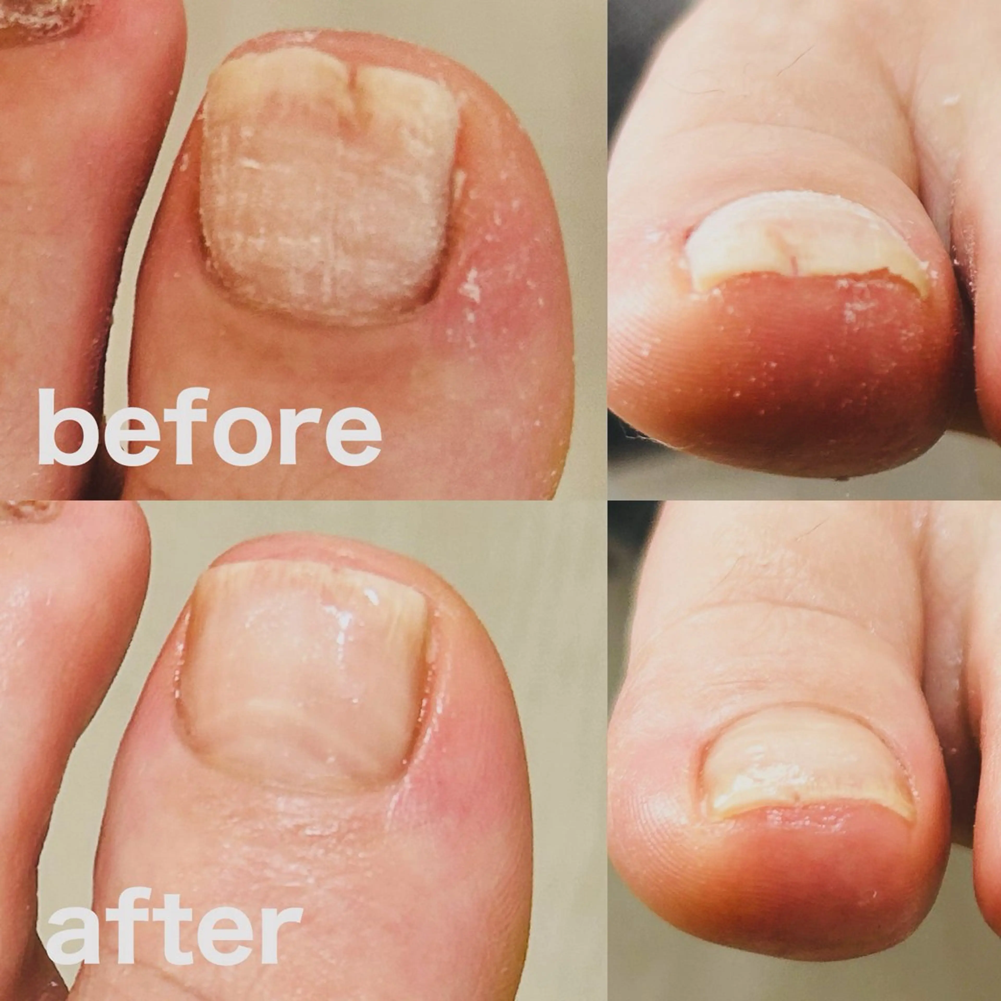 その他 巻き爪フットケアサロンKotori所属・フットケアサロン Kotoriのその他イメージ