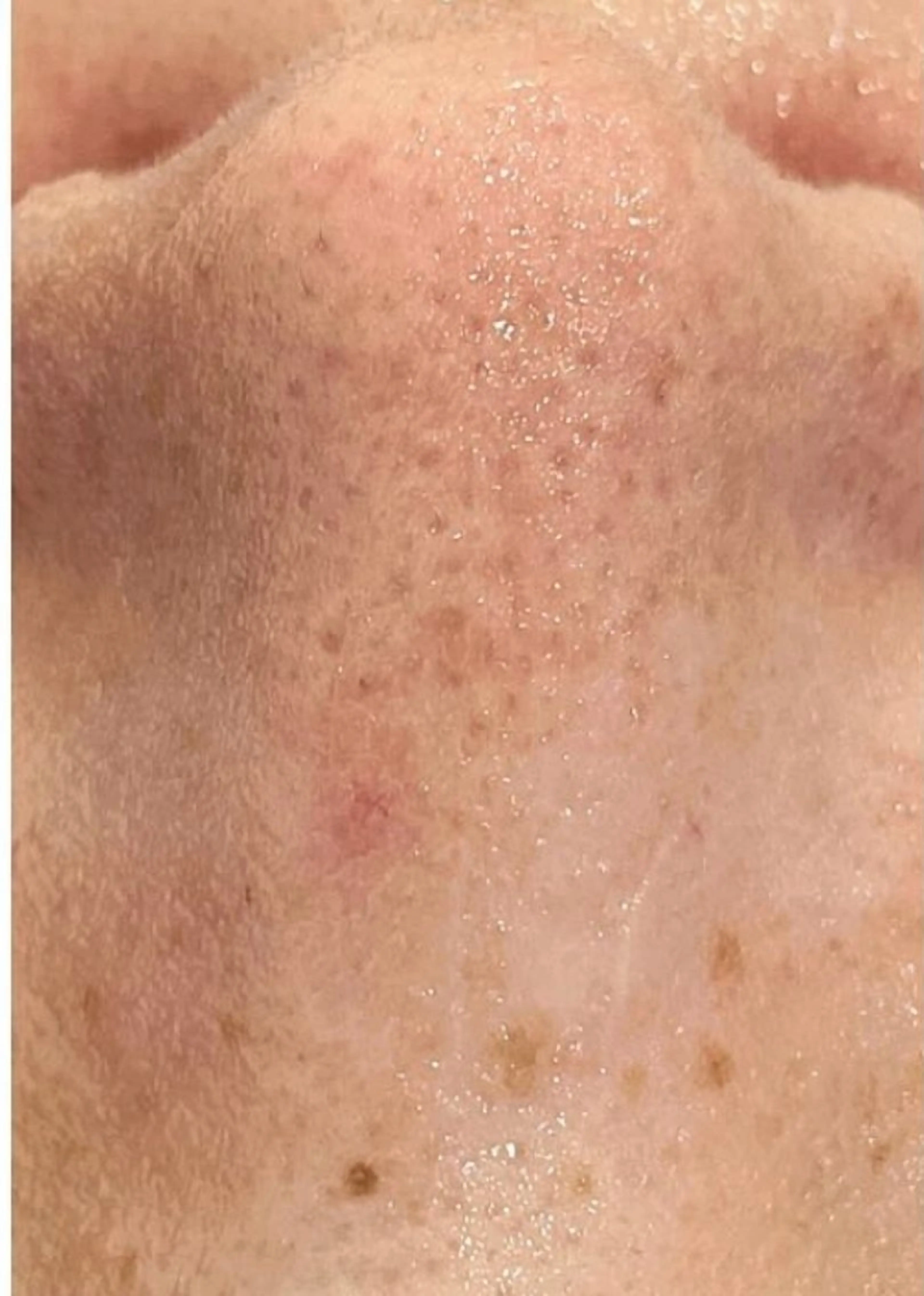 東京ビューティー 五反田店　nanaのエステ・リラクイメージ